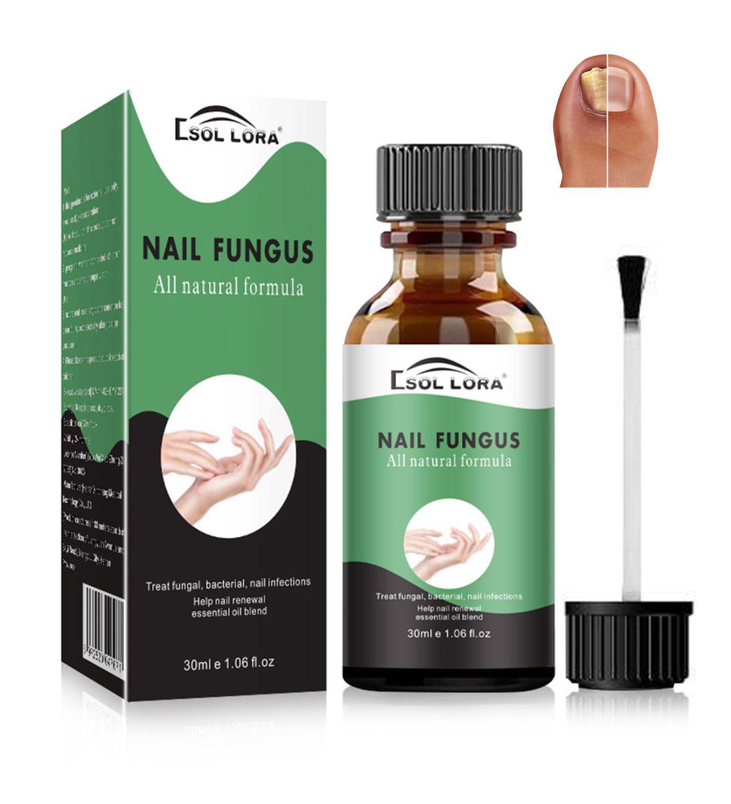 Fungal Nail Treatment - Extra Strong Nail Fungus Treatment for Toenail and Fingernail - Anti fungus Nail Repair and Strengthen Fix & Renew Damaged Broken Nails Restoring Healthy Nails-30ml - Buy Online on GoSupps.com