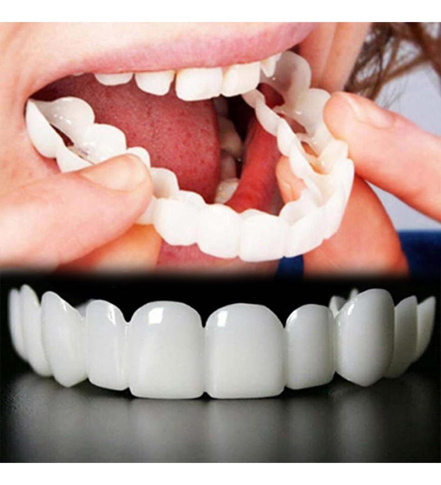 Buy WTTFC 2 Pairs of Dental Veneers - Upper & Lower Plug-In Cosmetic Temporary Teeth for Men & Women - Buy Online on GoSupps.com