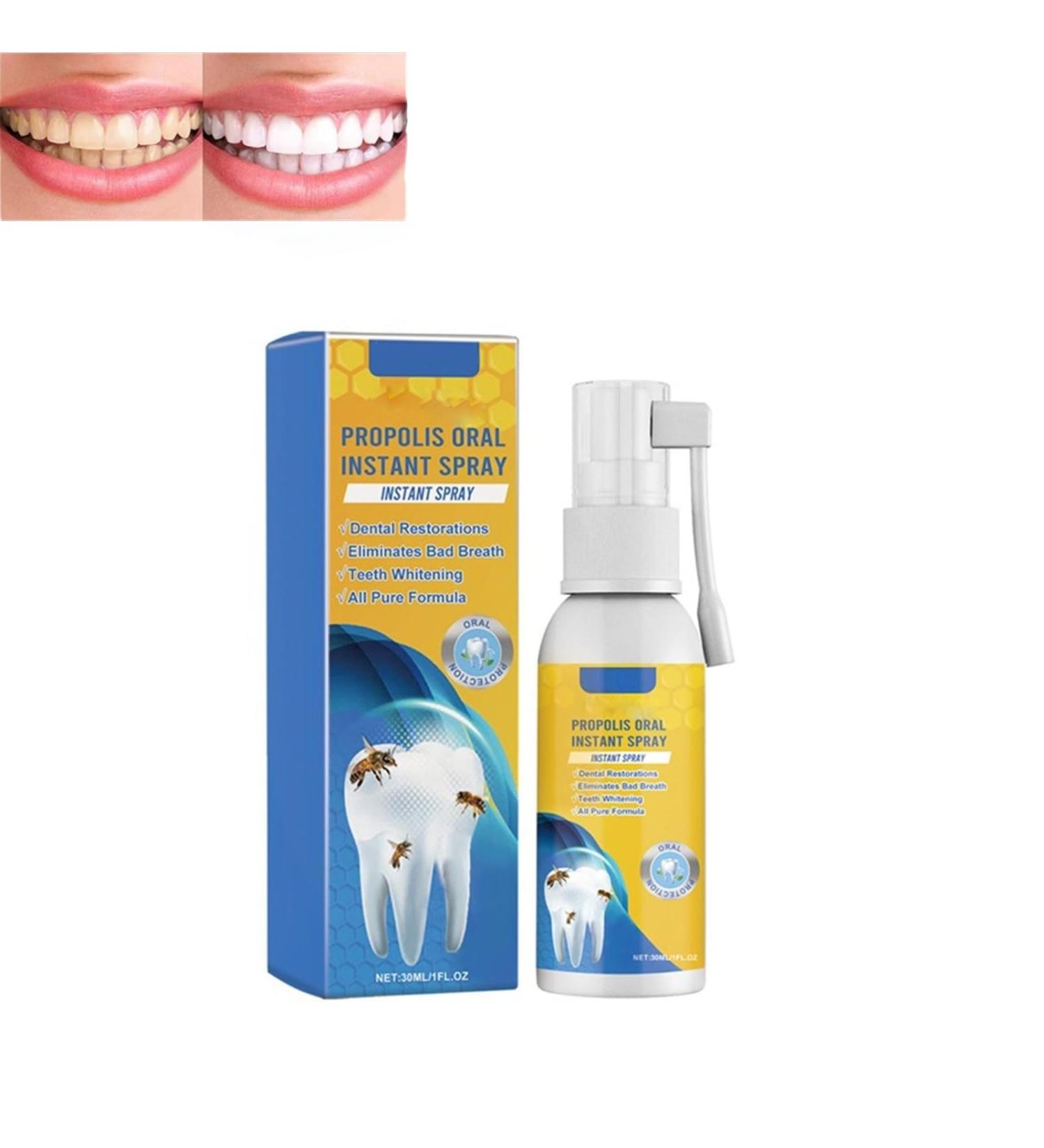 Propolis Oral Instant Treatment Spray - Deep Cleaning & Breath Refreshing Mouthwash | Furzero Propolis Oral Health Spray (1PC) - Buy Online on GoSupps.com