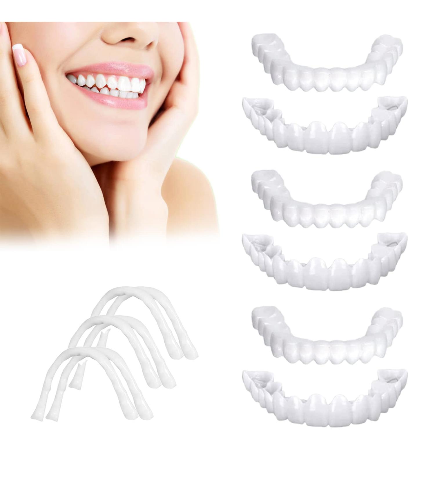 6 PCS Fake Dentures Teeth for Women and Men - Dental Veneers for Temporary Restoration - Comfortable & Natural Shade to Protect Teeth and Restore Smile - Buy Online on GoSupps.com
