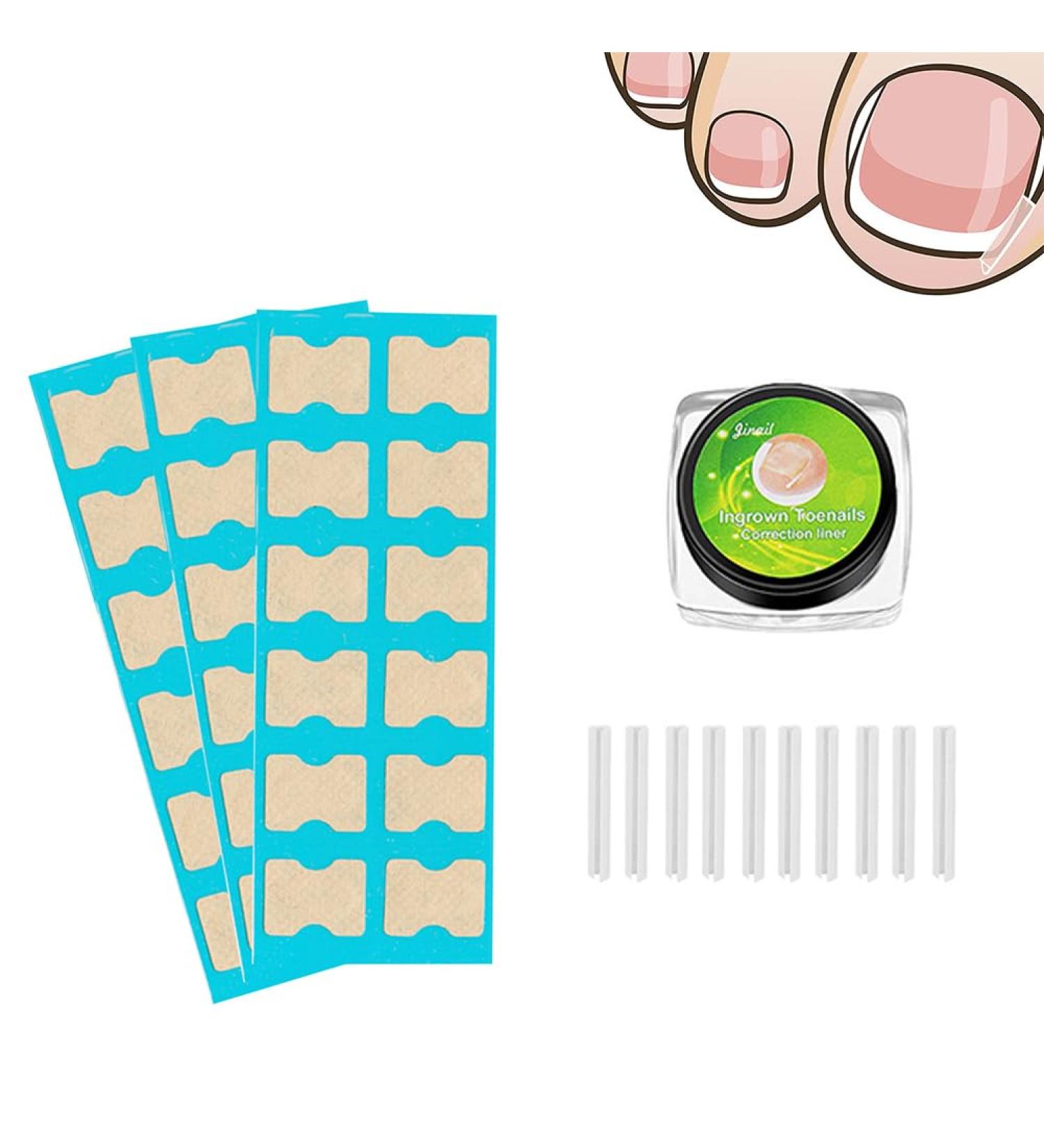 Ingrown Toenail Correction Patch Ingrown Correction Sticker 46 Pieces Ingrown Toenail Correction Patch Care Ingrown Nail Patch for Men Women - Buy Online on GoSupps.com
