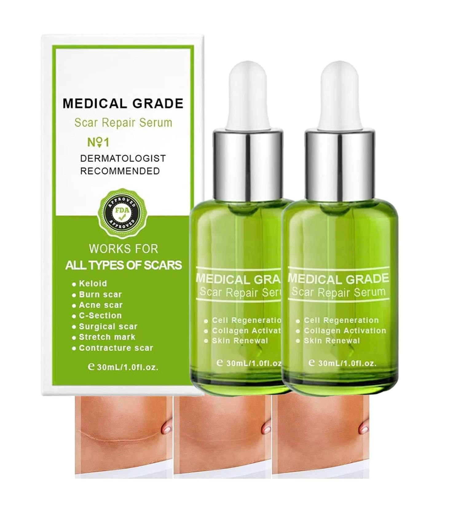 sjfscqr Natural Scar Repair Essence Medical Grade Scar Repair Serum Advanced Scar Repair Serum Suitable for All Types of Scars - Buy Online on GoSupps.com