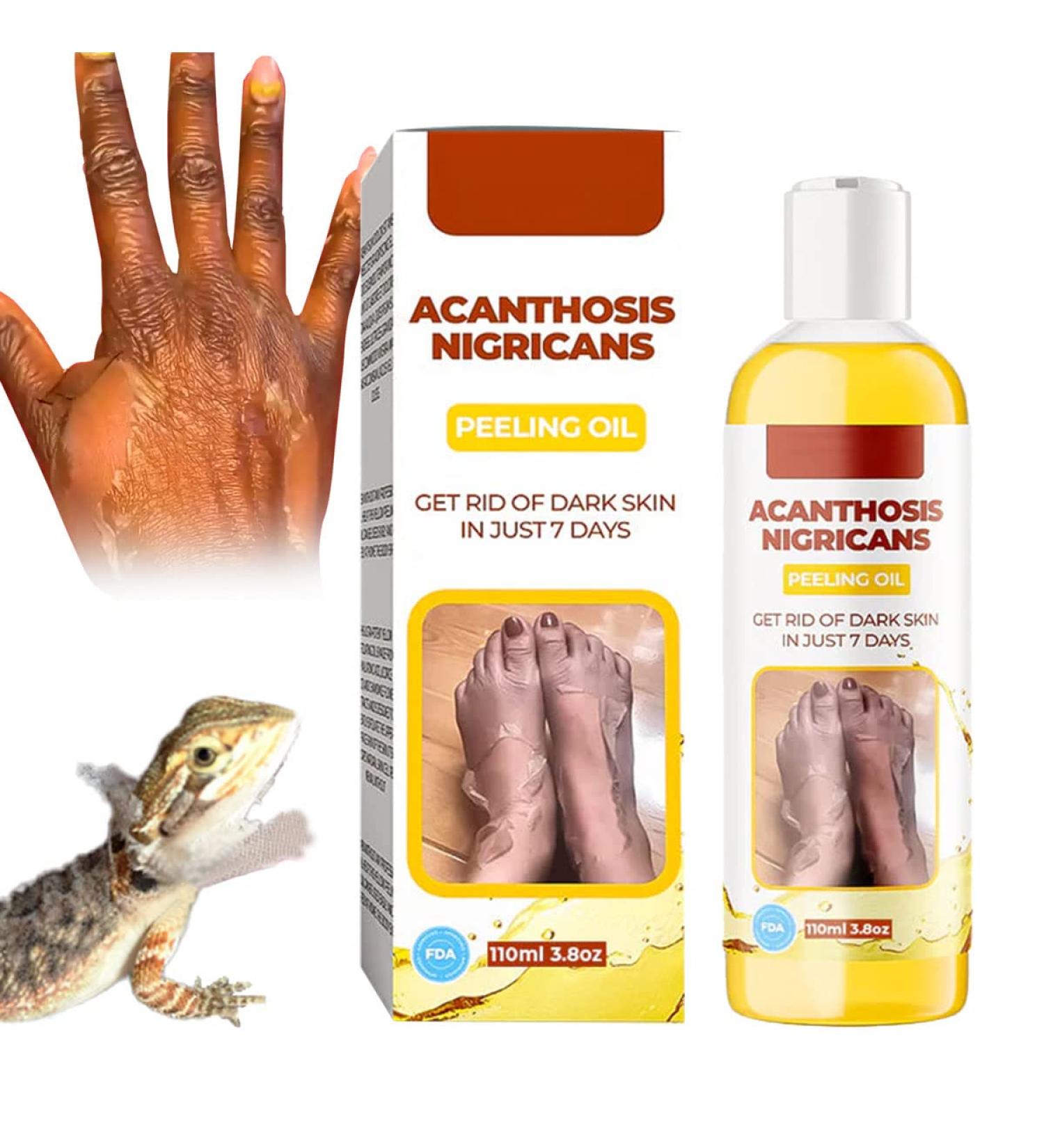 GFOUK Acanthosis Nigricans Dark Spot Peeling Oil - 1pcs - Buy Online on GoSupps.com