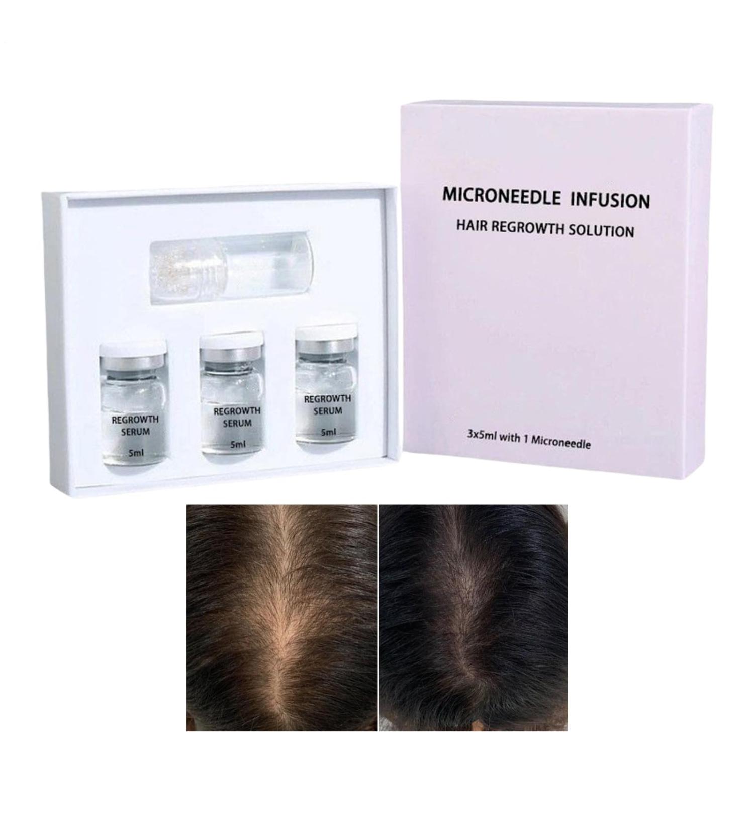 Hair Oil Hair Care Oil Liquid Conditioner with Plant Extracts for Women and Men Strengthening Hair Loss Prevention Scalp Care - Buy Online on GoSupps.com