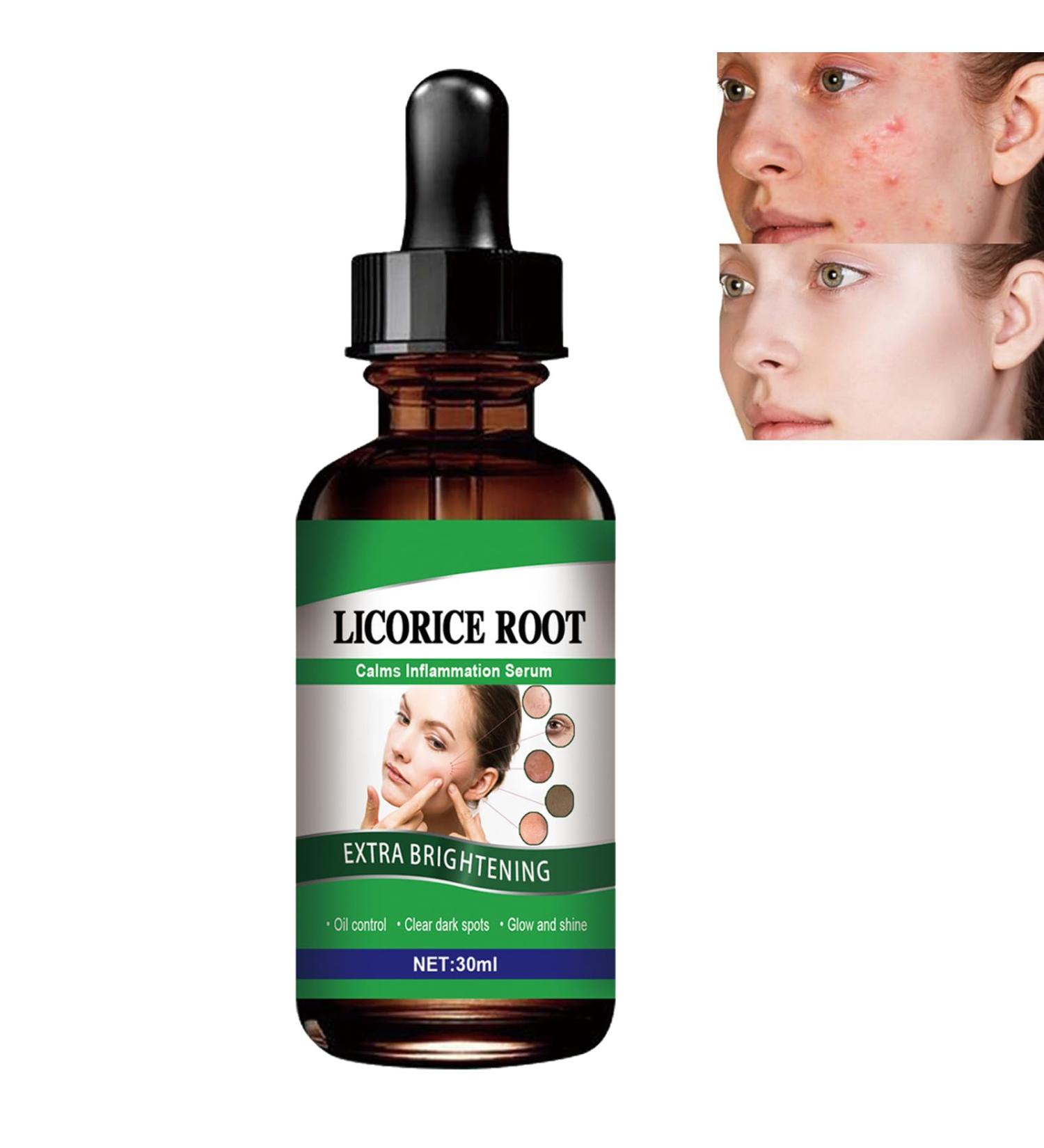 Licorice Pore Shrinking Facial Essence Whitening Rejuvenating Essence Licorice Dark Spot Corrector Essence Natural Licorice Repair Face Serum Licorice Skin Brightening Essence Tightening Skin Care - Buy Online on GoSupps.com