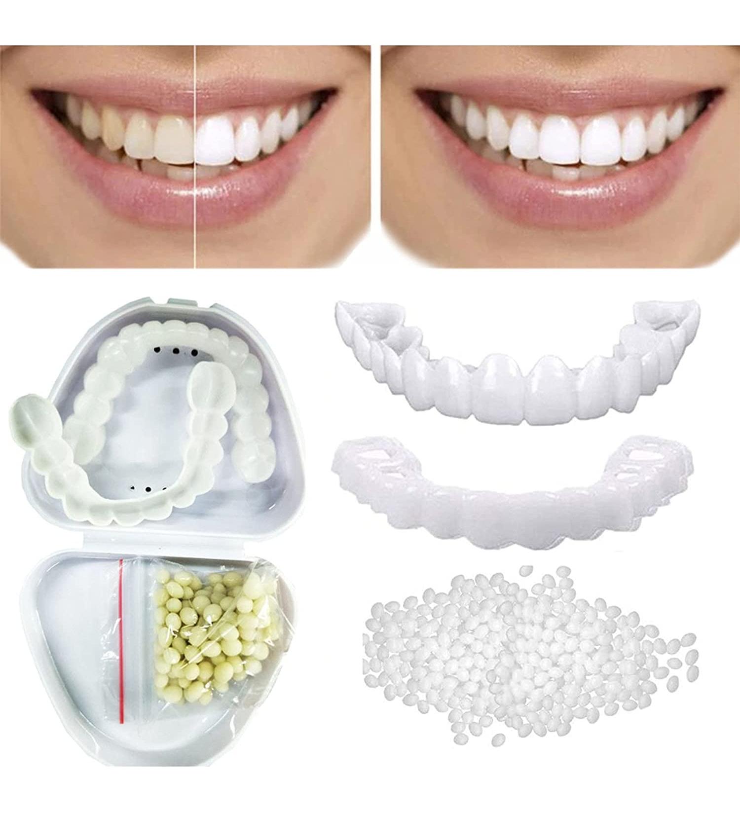 Giural 2 Pairs Cosmetic Veneers - Instant Upper & Lower Snap-On Teeth Prostheses for Bad Teeth | Comfortable & Affordable Solutions - Buy Online on GoSupps.com