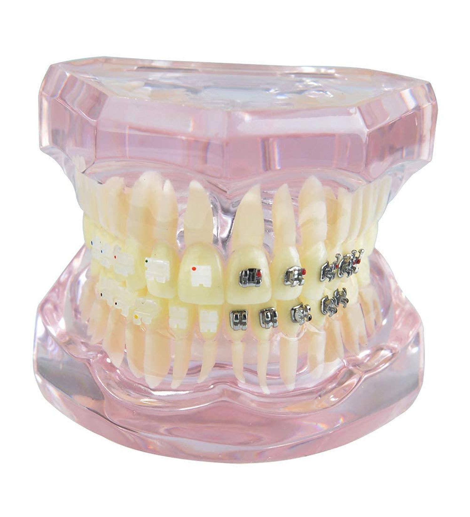 Samnuerly Dental Orthodontic Brackets Model - Ideal for Research & Treatment in Dentistry | International Shipping - Buy Online on GoSupps.com