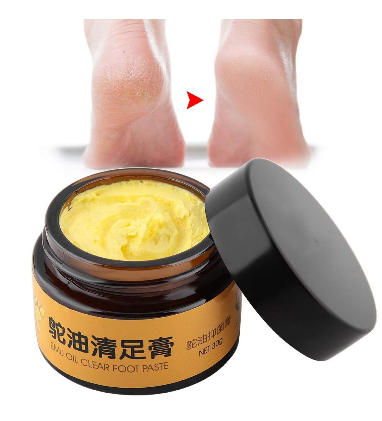 Foot Care Cream - 30G Plant Extracts Moisturizer for Cracked Heels & Itchy Feet | Buy Now! - Buy Online on GoSupps.com