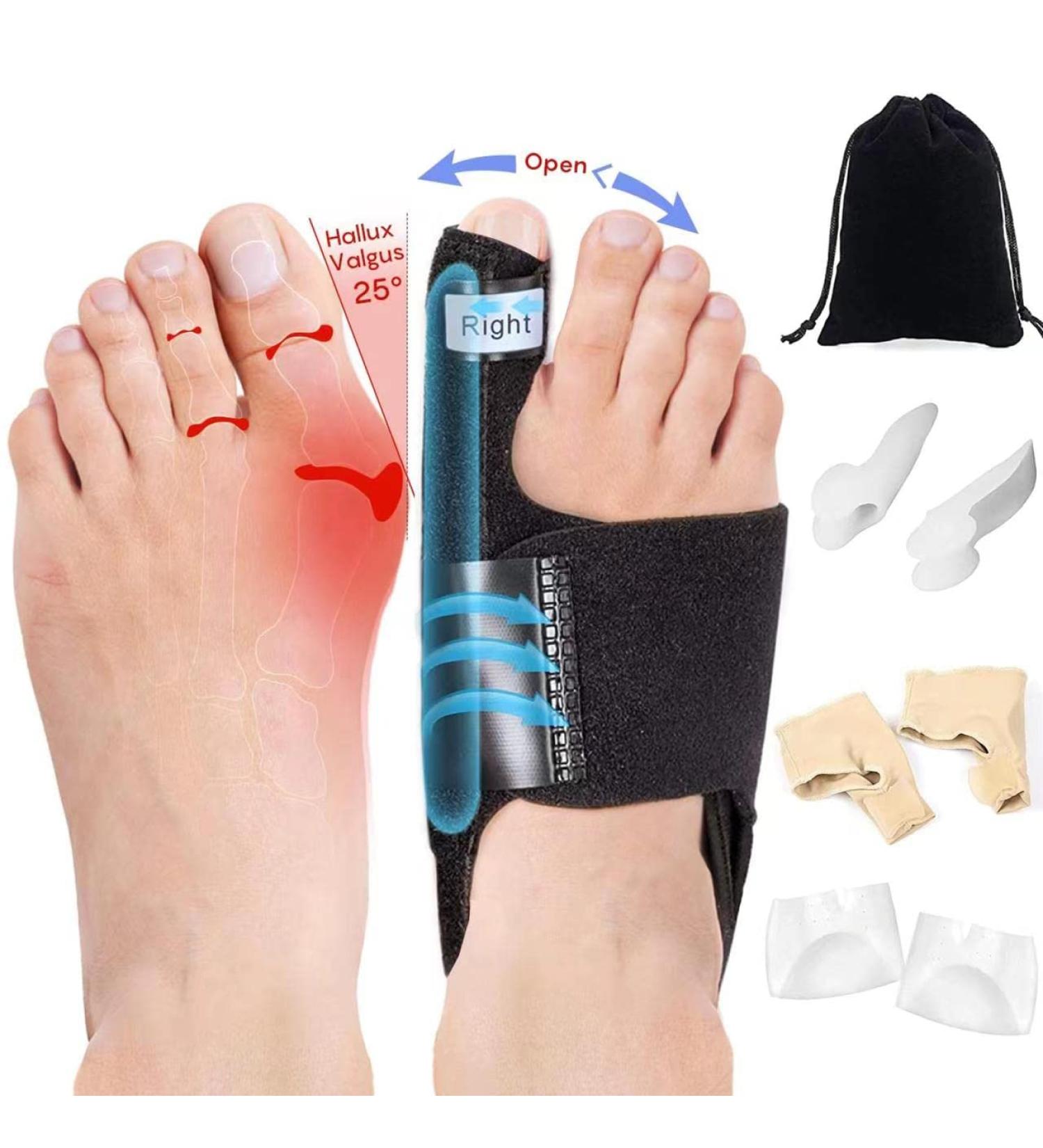 SEKOESS Bunion Corrector Kit for Women & Men - 9Pcs Non-Surgical Toe Straightener, Orthopedic Separator, Breathable & Non-Slip Splint for Day/Night Relief - Buy Online on GoSupps.com