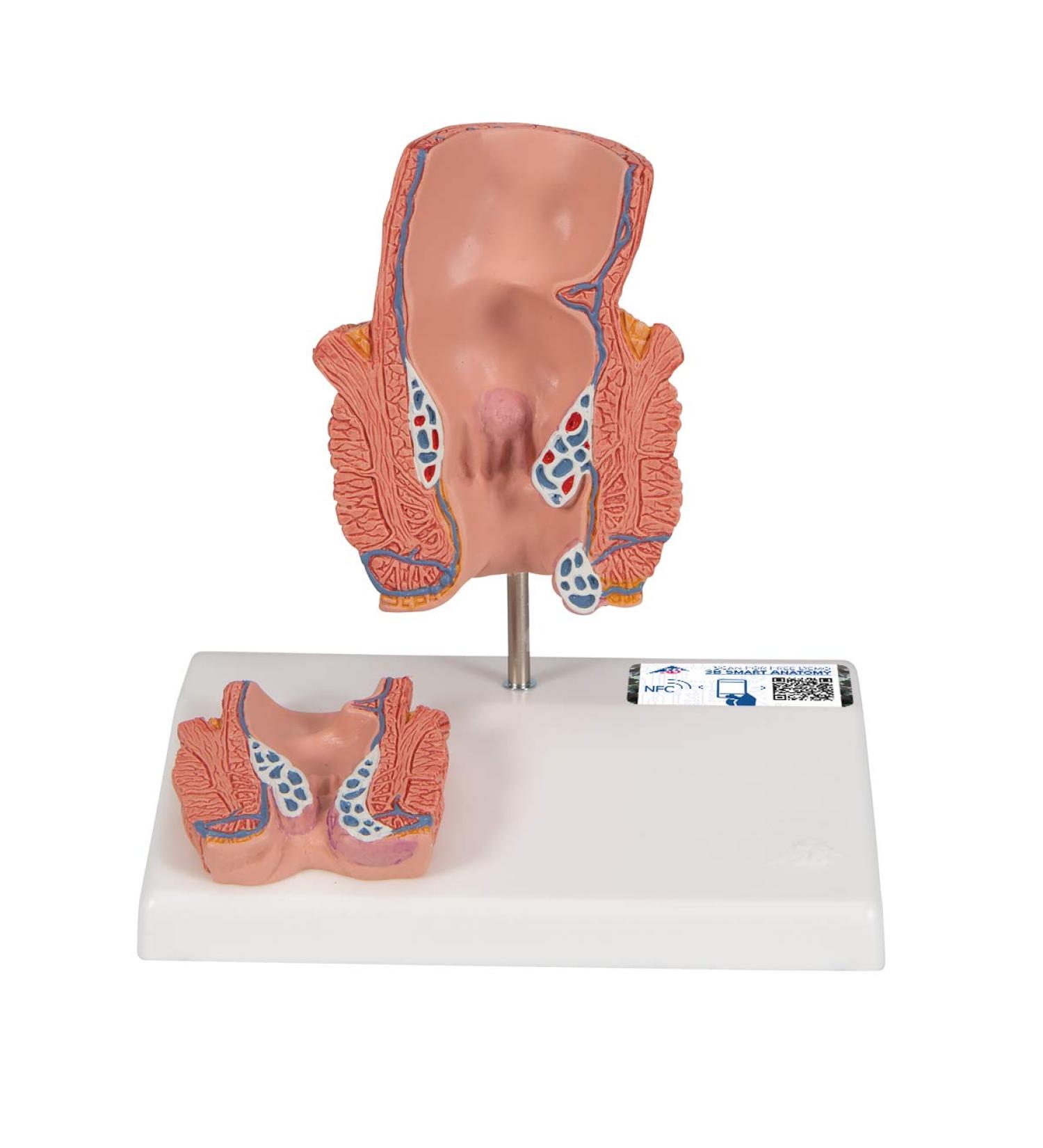3B Scientific K27 Hemorrhoid Model with Smart Anatomy | Educational Tool - Buy Online on GoSupps.com