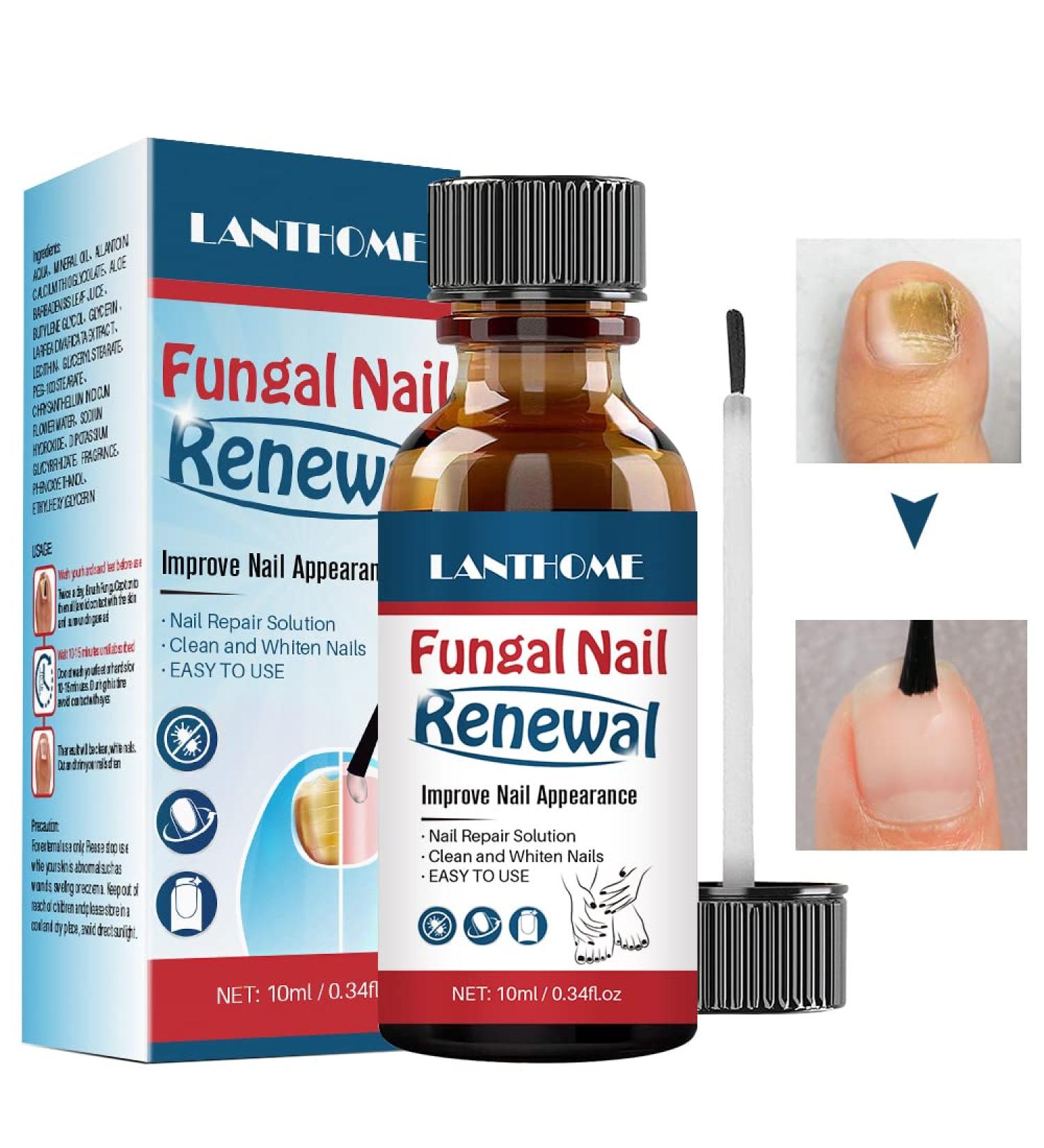 Nail Treatment Repair Toe Nail Repair Treatment Extra Strength Toenail Repair Solution Nail Renewal Liquid For Discoloration Nail & Toenails(10ML) - Buy Online on GoSupps.com