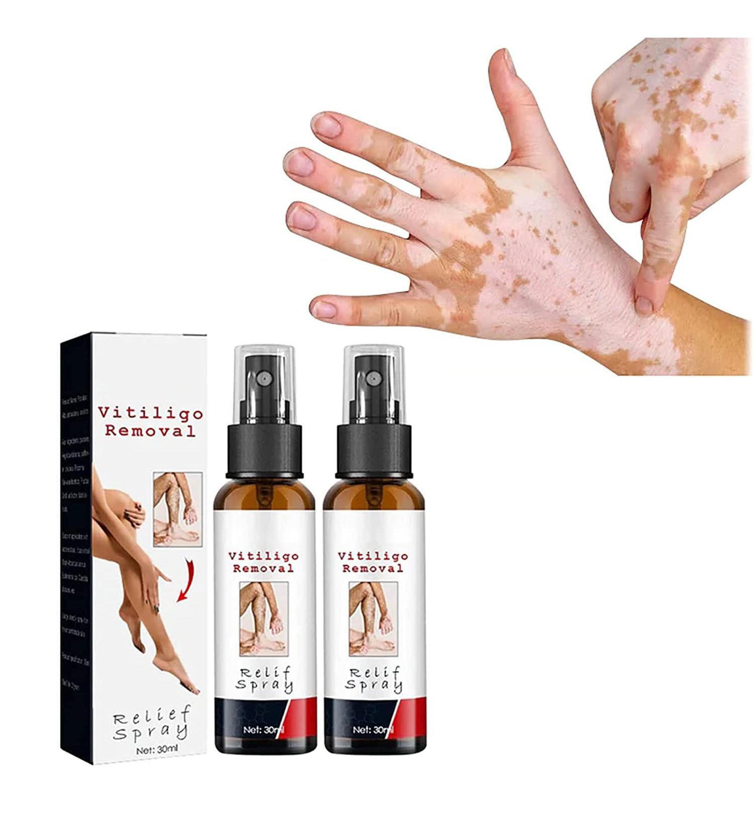 DUBUSH Vitiligo Kalmerende Spray Vitiligo Skin Repair Spray - Buy Online on GoSupps.com