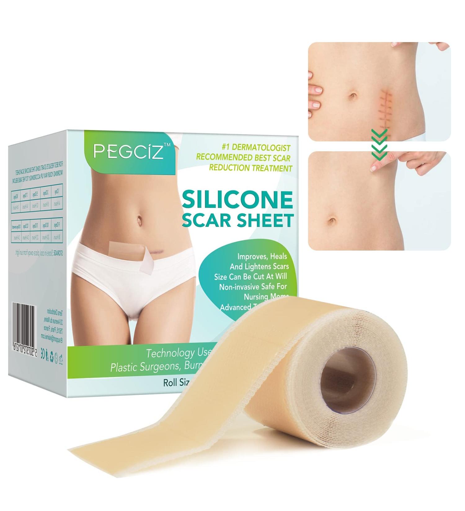 Silicone Scar Sheets - Professional Scar Removal Tape for C-Section, Surgery, Burn, Keloid, Acne - Soften and Flatten Scars - 1.6 x 120 - 3M Roll - Buy Online on GoSupps.com
