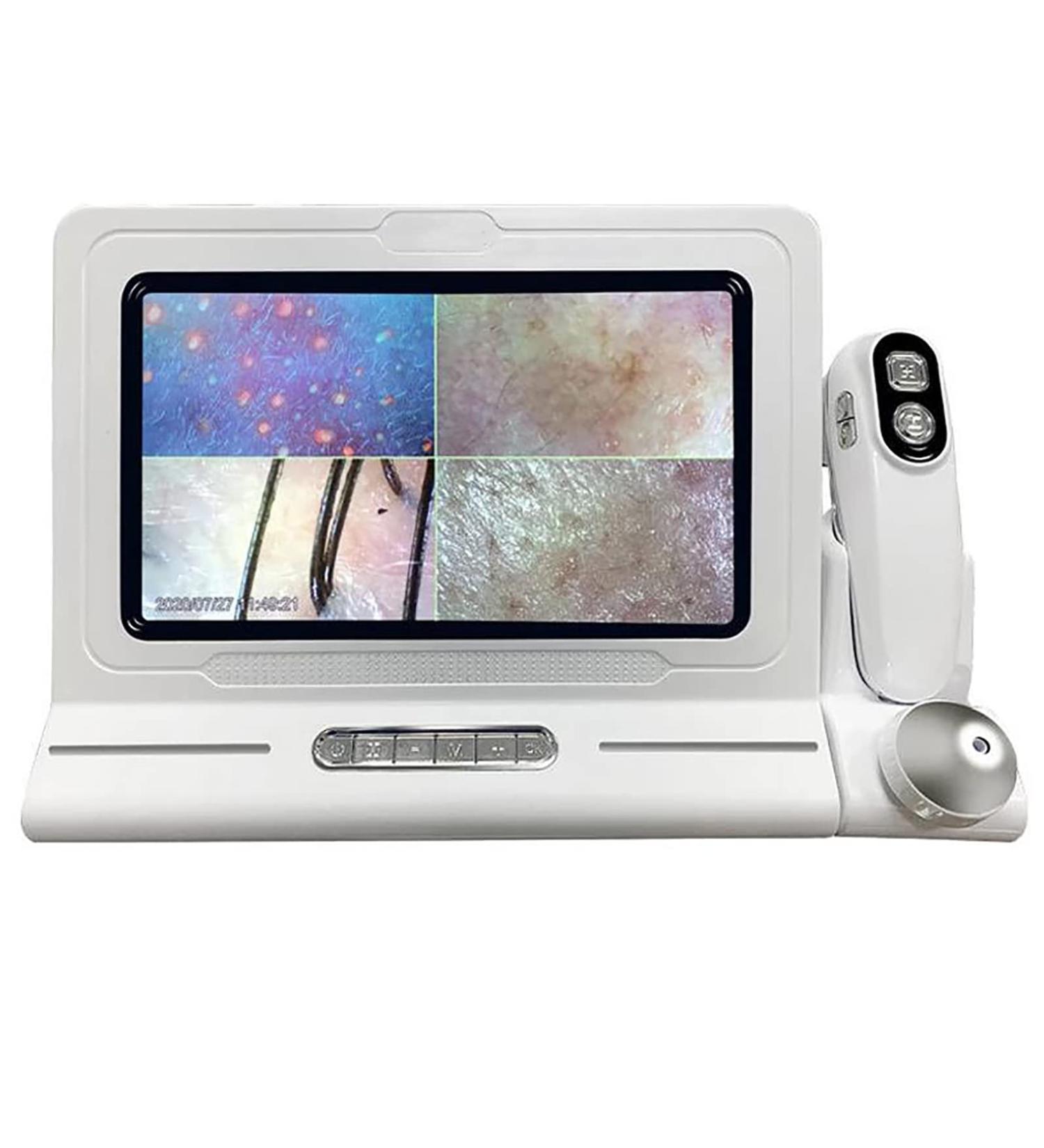 Skin Diagnosis Analyzer Hair Follicles Scalp Detector with 14.5 Inches HD Screen Configuring Dual Probes 200x 50x Four-Picture Comparison for Beauty Salon Hair Salon - Buy Online on GoSupps.com