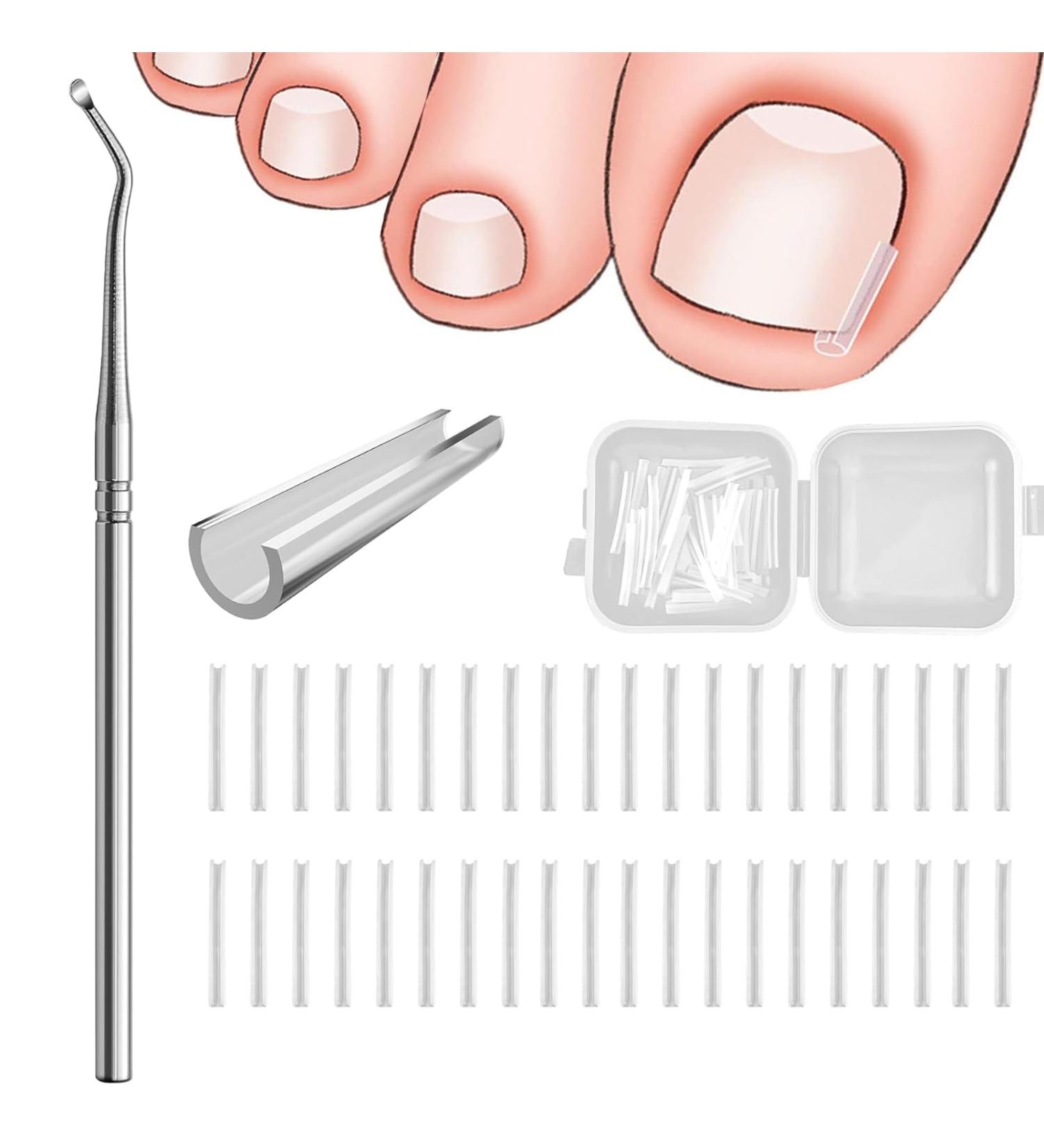 Ingrown Toenails Set Toenail Correction Patch Nail Clip Toenails Ingrown Toenails Toenail Correction with Lifter for Ingrown Toenails 40 Pieces - Buy Online on GoSupps.com