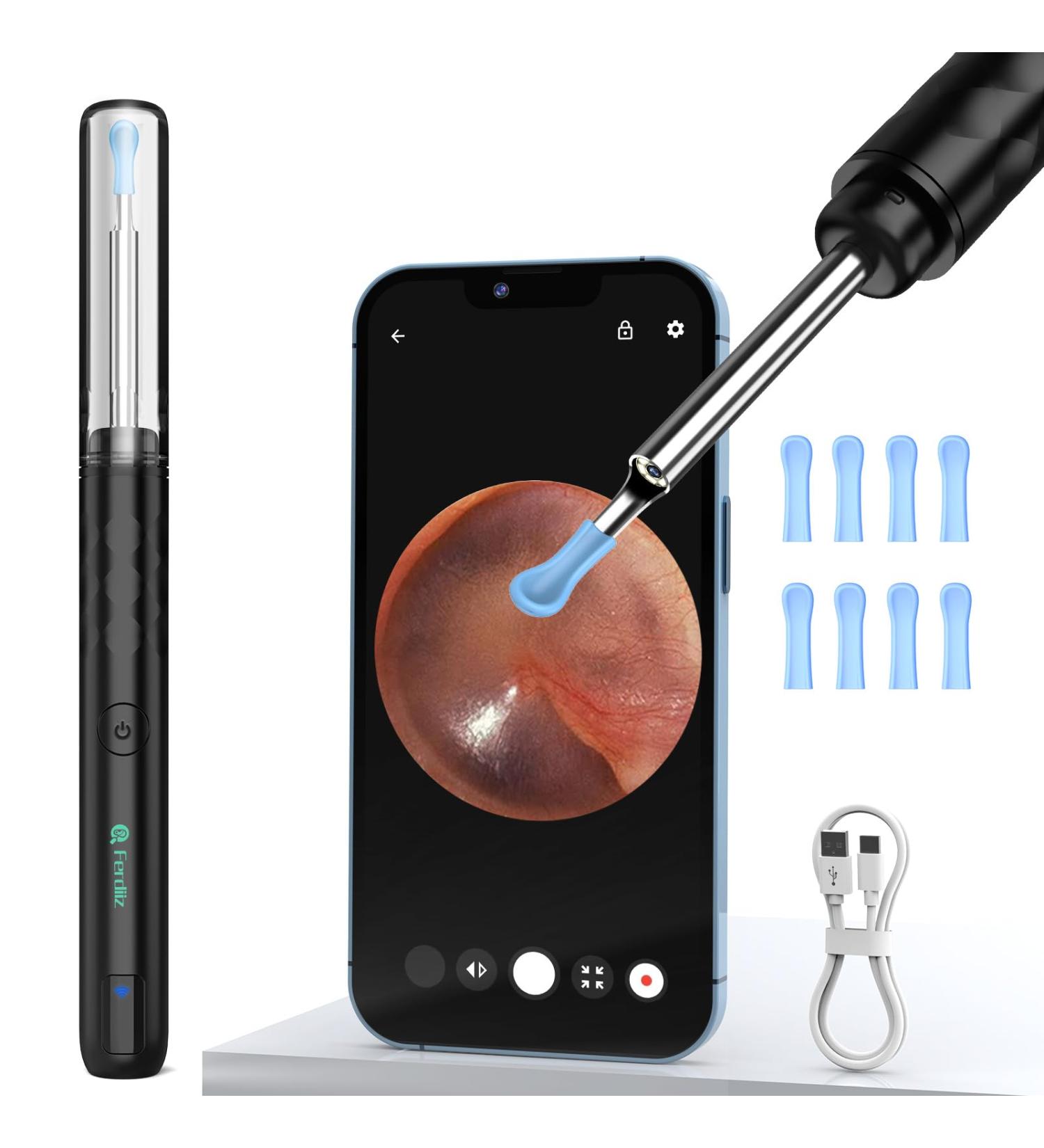 Ear Wax Removal Tool Camera Ferdiiz Ear Cleaner with 1080P Camera Ear Cleaning Kit with Lights Wireless Otoscope with 4 Reusable Soft Ear Picker for iOS Android Phones Adults Kids Pets - Buy Online on GoSupps.com