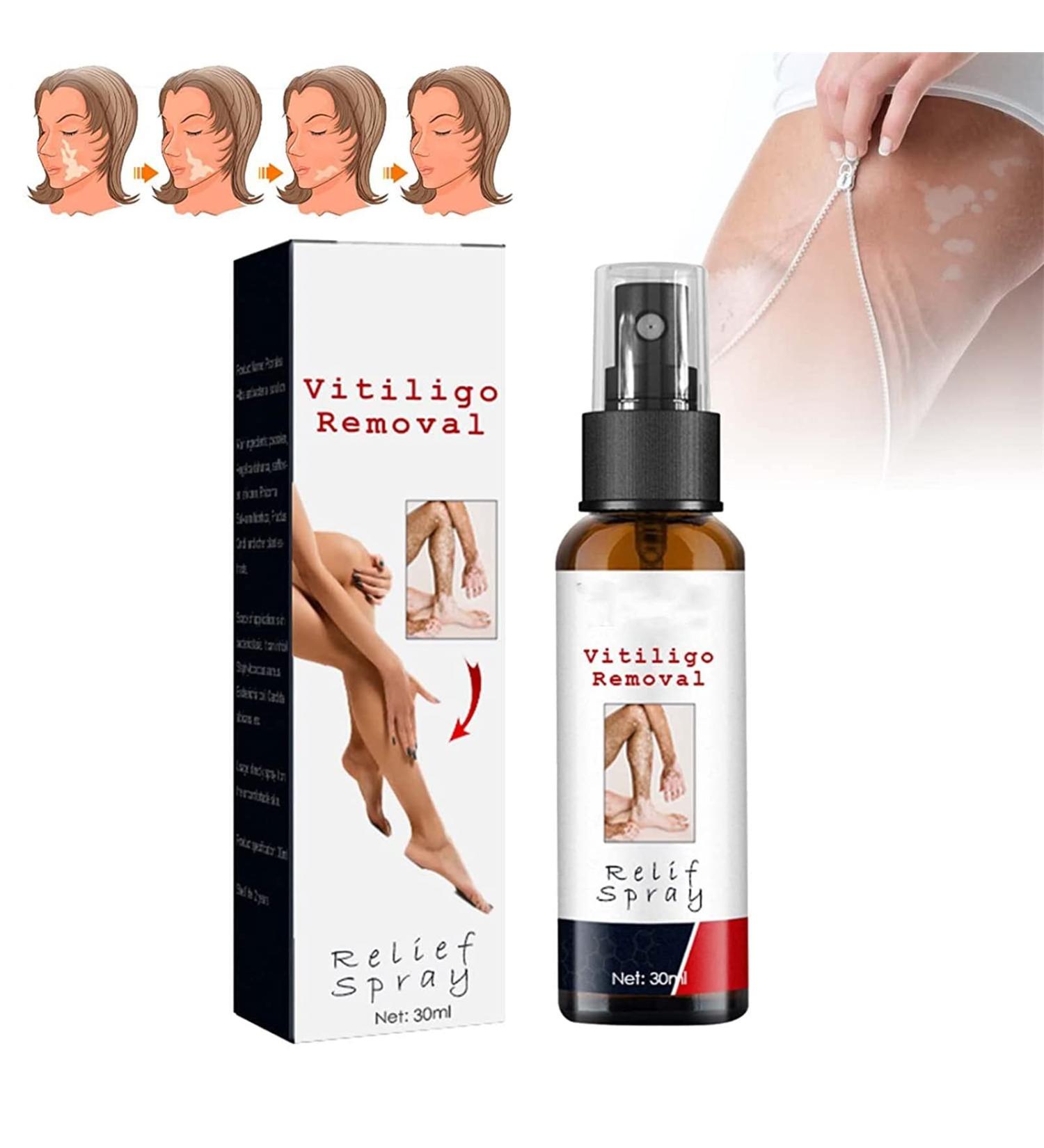 DUBUSH Vitiligo & Psoriasis Relief Spray - Skin Repair Treatment for Reducing White Spots - Soothing & Moisturizing Formula - 1 Pcs - Buy Online on GoSupps.com
