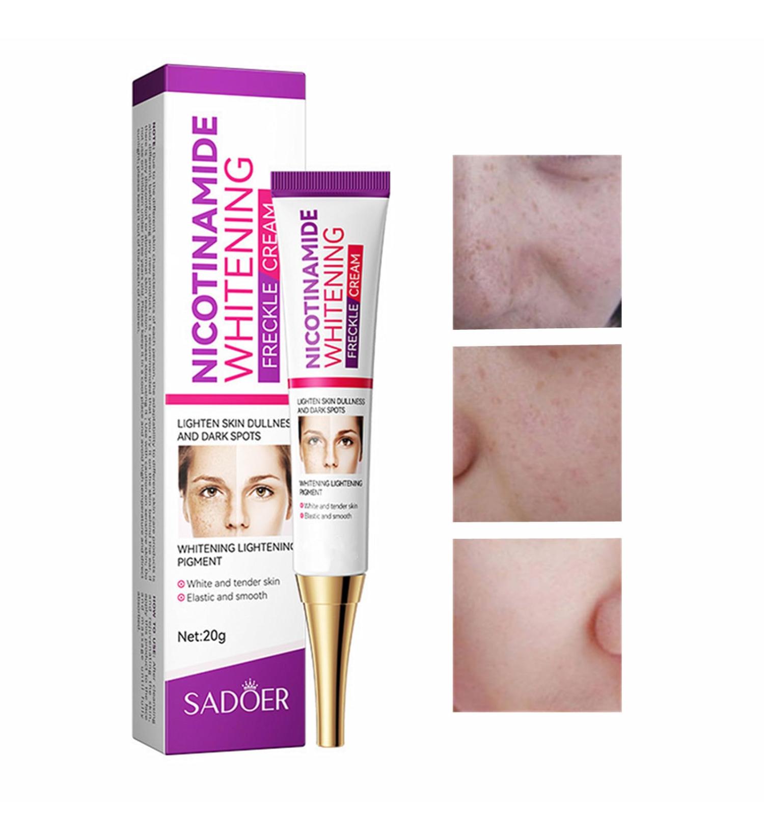 Dark Spot Remover & Skin Lightening Cream - Brightening Treatment for Face & Body | Freckle & Hyperpigmentation Corrector - 0.71oz - Buy Online on GoSupps.com