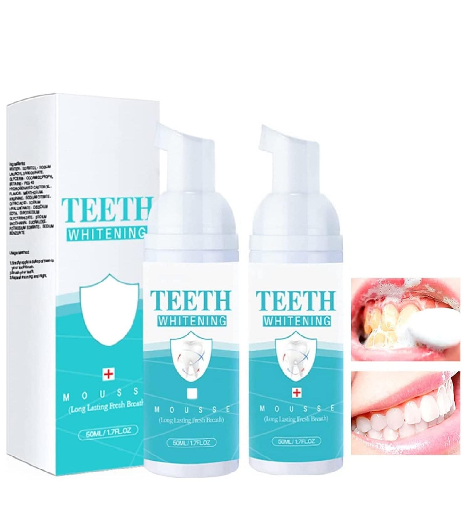 Teeth Whitening Mousse - 2pcs Cleansing Foam for Intensive Stain Removal | Improve Brightness, Reduce Yellowing | Mouthwash - Buy Online on GoSupps.com