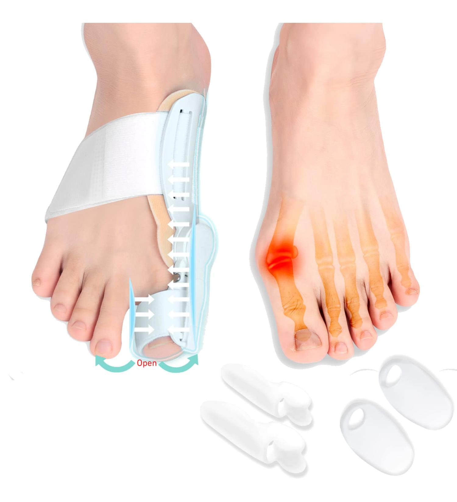 PlamPlam Bunion Corrector Kit - 2 Pack Night Toe Straightener + 4 Pack Daily Toe Spacers for Men and Women - Orthopedic Pain Relief and Toe Alignment Set - Buy Online on GoSupps.com