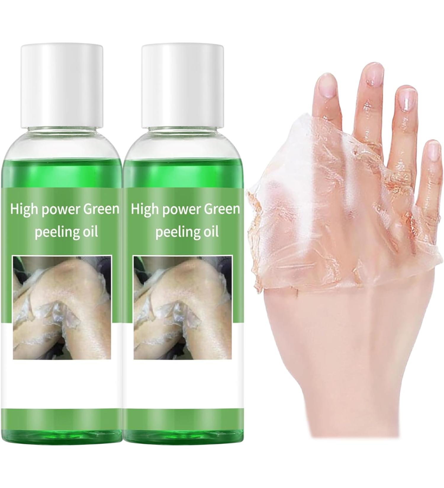 Extra Strong Green Peeling Oil Extra Strong Peeling Oil for Dark Skin Yellow Peeling Oil Extra Strong Peeling Oil Extra Strength Exfoliating Peeling Solution for Hand Feet Dead Skin Remover (2PC) - Buy Online on GoSupps.com