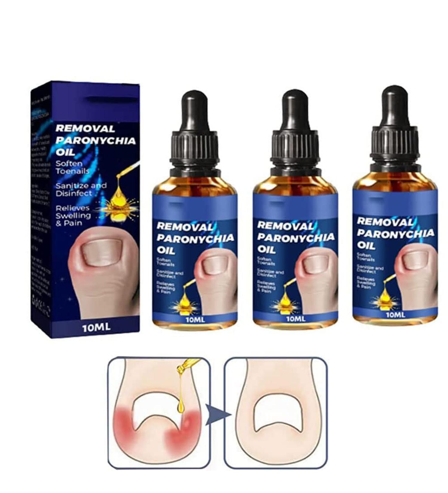 LWuuywa German Toenailplus Anti-Paronychia Relief Oil 10ml Correction Treatment Oil Nail Care Nail Growing Anti-Paronychia Aid Oil Ingrown Nail Drops - Buy Online on GoSupps.com