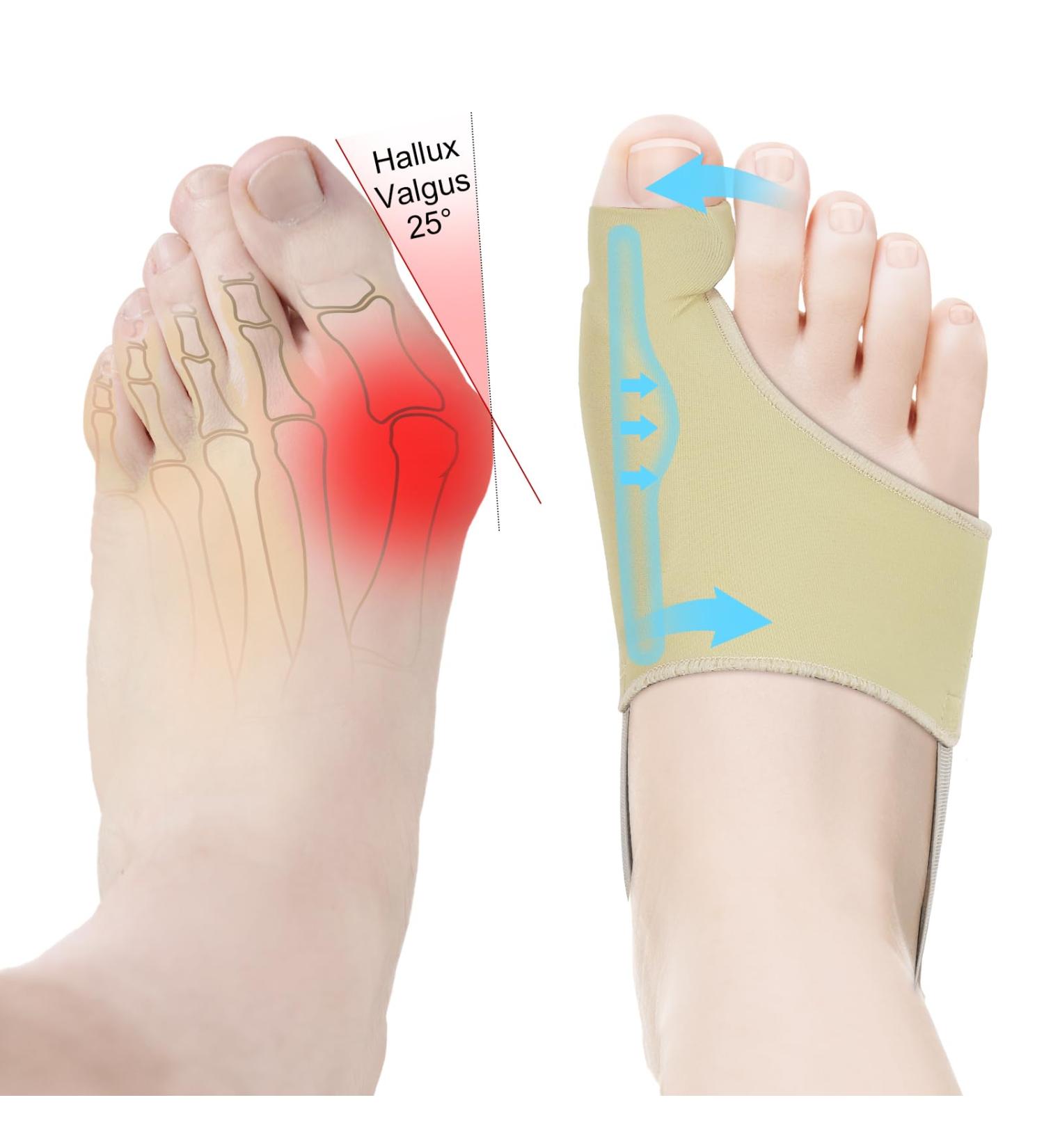 KTSAY Upgraded Bunion Corrector 2 Pcs Non-Surgical Toe Socks for Women & Men - Comfortable Day/Night Support for Hallux Valgus Pain Relief - Buy Online on GoSupps.com