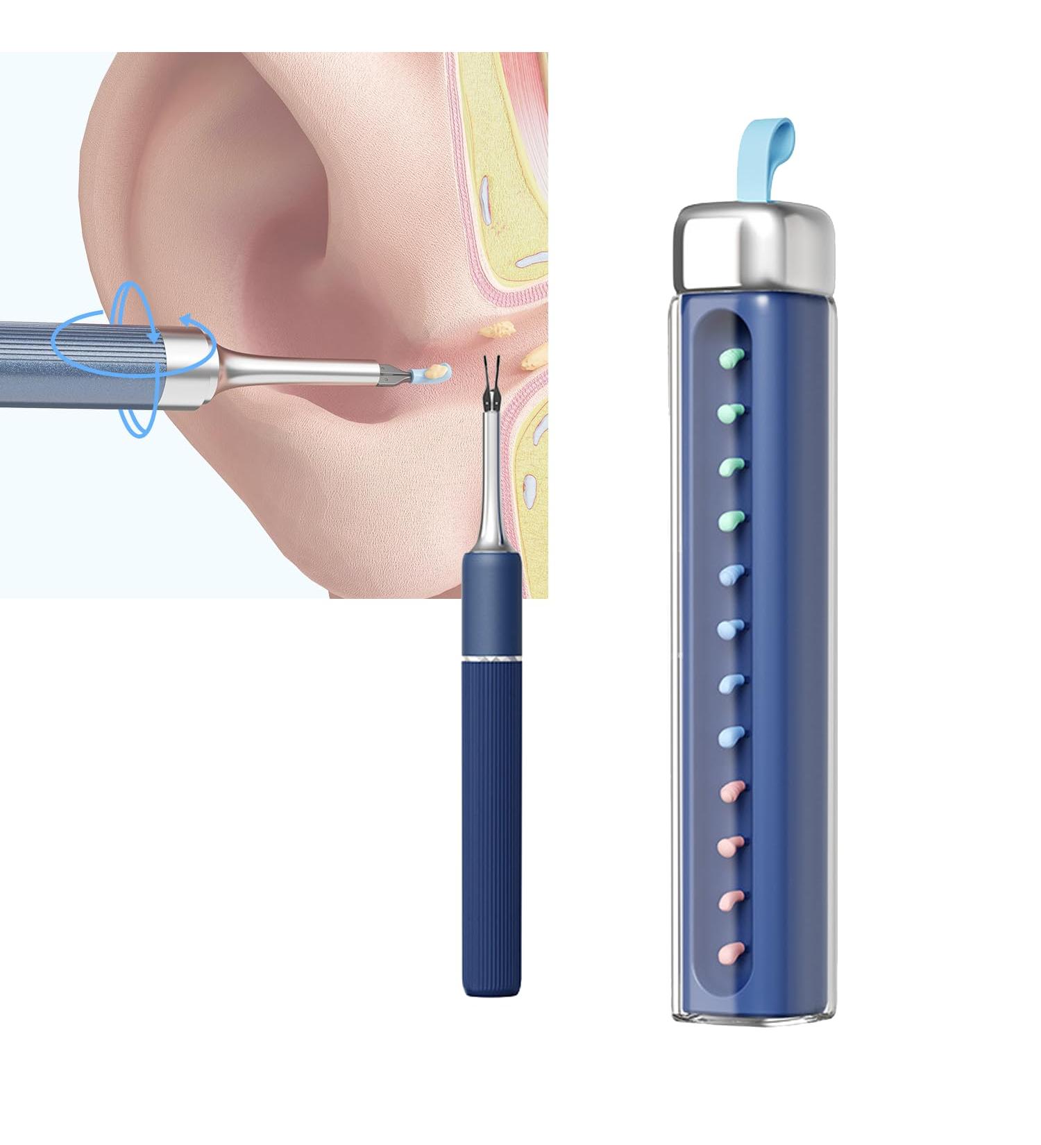 Ear Wax Removal Tool All-purpose Ear Picking Tweezers 8 Million Pixels Six-axis Gyroscope 3.2mm Lens Diameter 10-50mm Lens Depth 1.4-2cm Lens Focal Length Real-Time Remote Video Otoscope - Buy Online on GoSupps.com