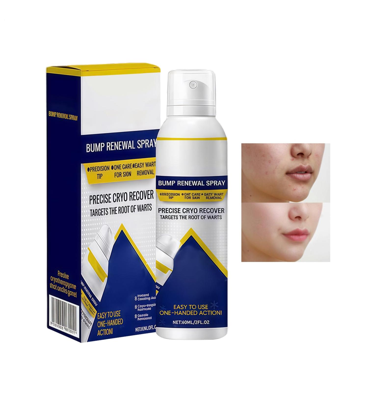 Soothing Face Spray - 60ml Herbal Quick Absorbing Moisturizing Face Mist - For Women Men Teens Young Adults and Family - Buy Online on GoSupps.com