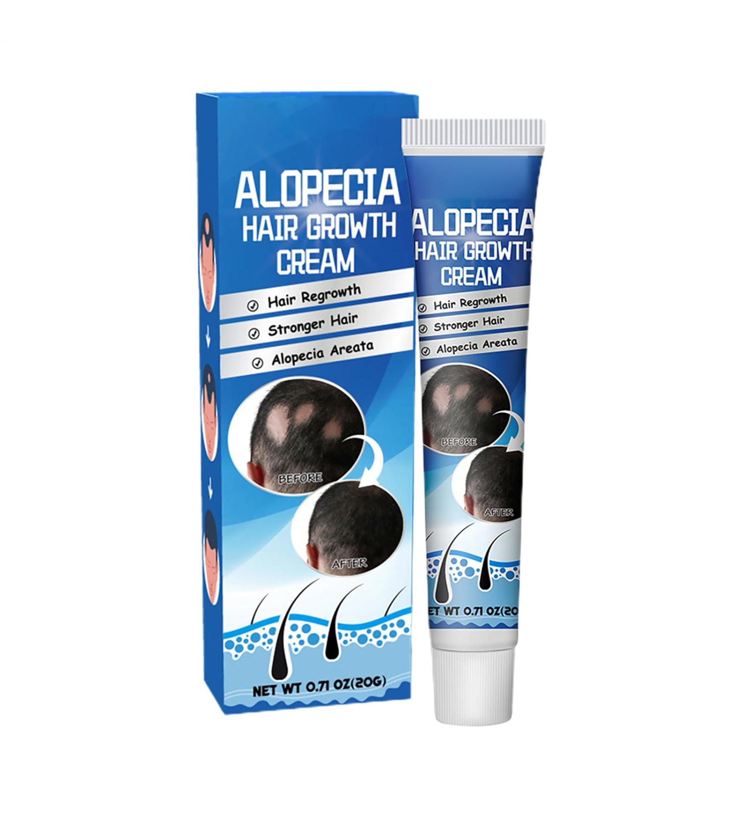  G n rique Baldness Cream - 20g Hair Growth Oil for Fast-Acting Effective Use Anti-Alopecia with High Hairline Solution Hairless Baldhead Hair Development Moisturizer for Men Women Thinning - Buy Online on GoSupps.com