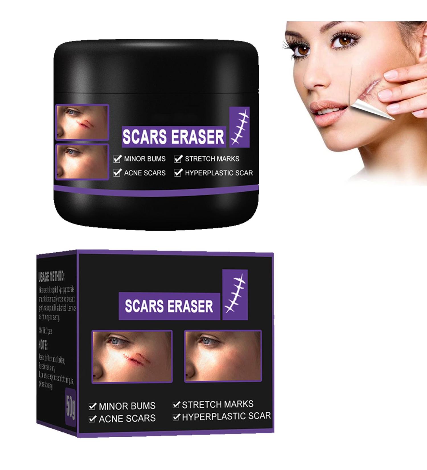 Scar Removal Cream 50ml - C-Section Skin Repair, Stretch Marks & Acne Surgery Treatment - Buy Online on GoSupps.com