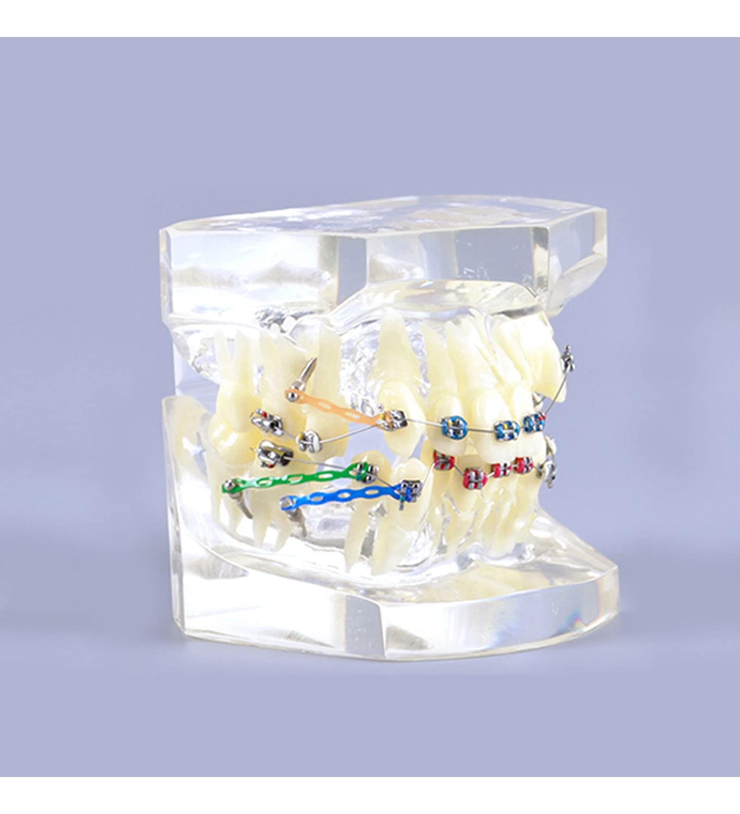 Bovdc Orthodontic Tooth Model for Malocclusion Study - Dental Education & Treatment Guide - Buy Online on GoSupps.com