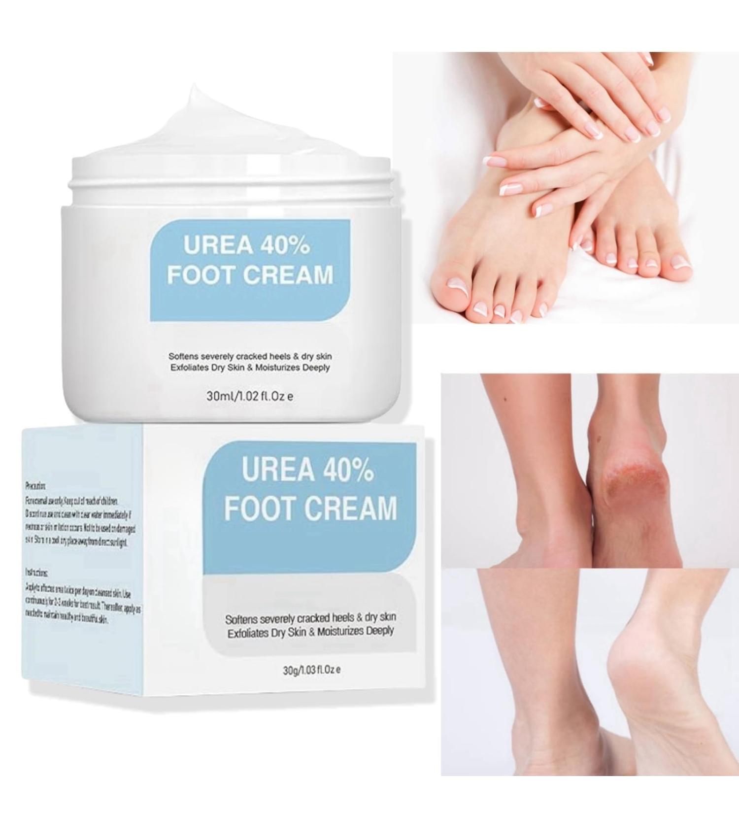 Urea 40% Foot Cream Cracked Heel Repair Cream Foot Cream for Cracked Heels and Dry Skin Cracked Heel Repair Cream Urea Foot Cream Foot Moisturiser Skin Care Hands & Feet Cracked Heel Cream Heel Repair - Buy Online on GoSupps.com