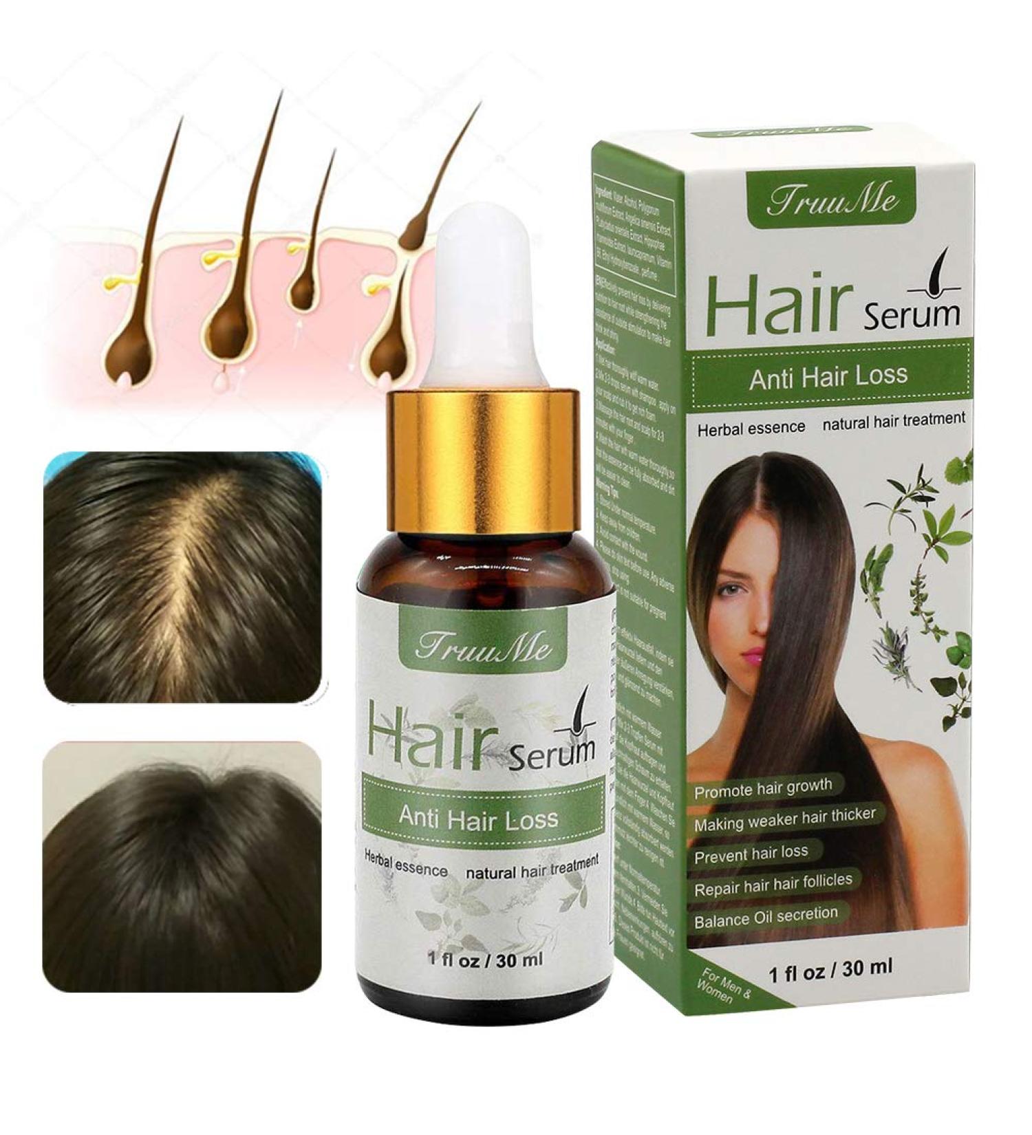 Natural Hair Growth Serum - Anti-Hair Loss & Thickening | Herbal Essence for Thinner Hair (30 ml) - Buy Online on GoSupps.com