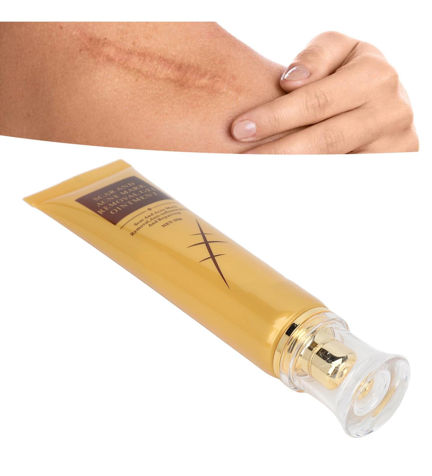 Scar Repairing Gel with Easy-to-Use Soft Texture Plant Extract Ingredients for Refreshing Skin - Reduces Scars & Spots - 30g/1.1oz - Buy Online on GoSupps.com