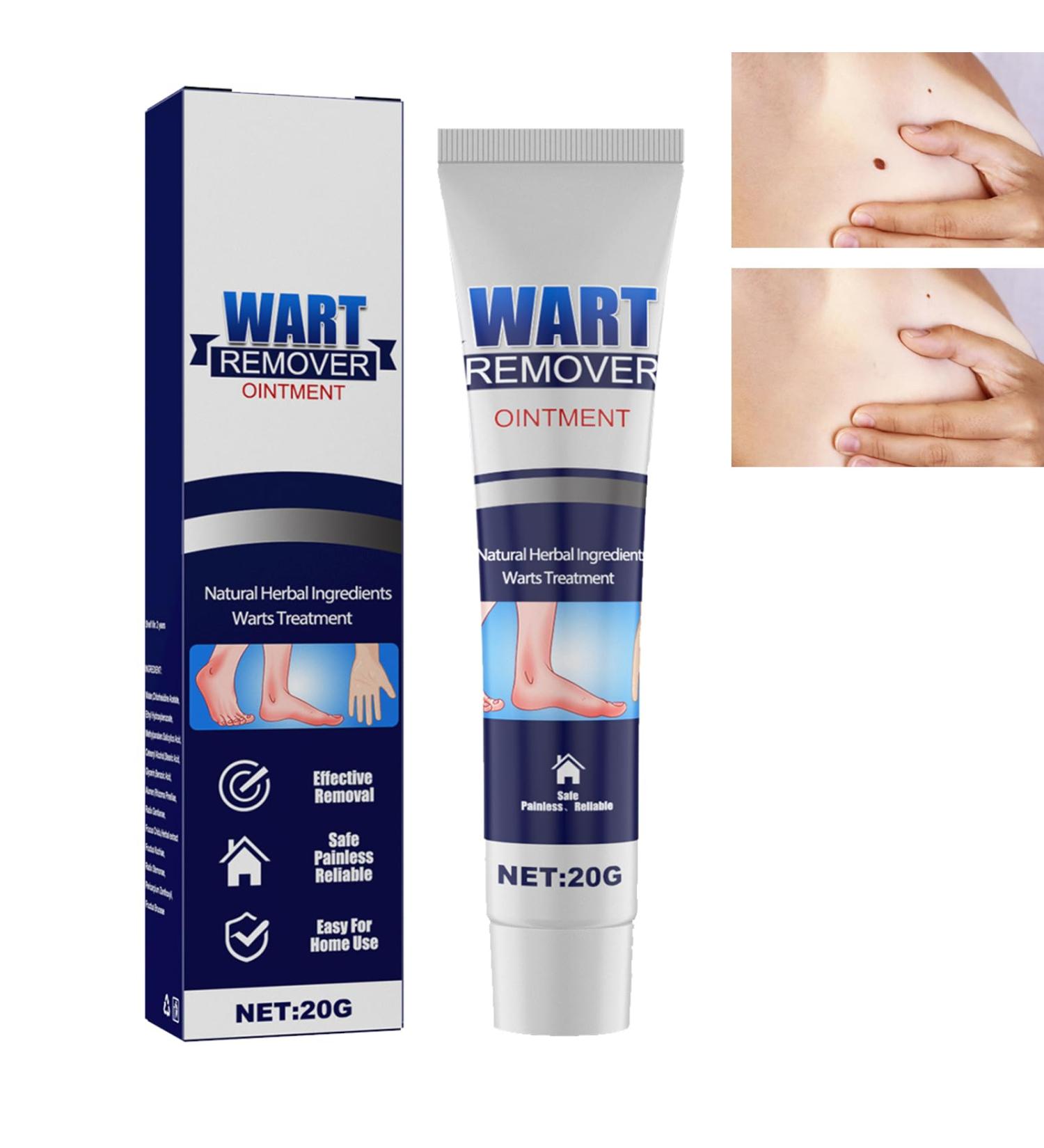 Pommade Anti-verrues Cr me Anti- tiquettes Cutan es Cr me D' limination Instantan e des Verrues Pommade Anti-verrues Skin Deluxe Cr me Anti-imperfections Instantan e - Buy Online on GoSupps.com