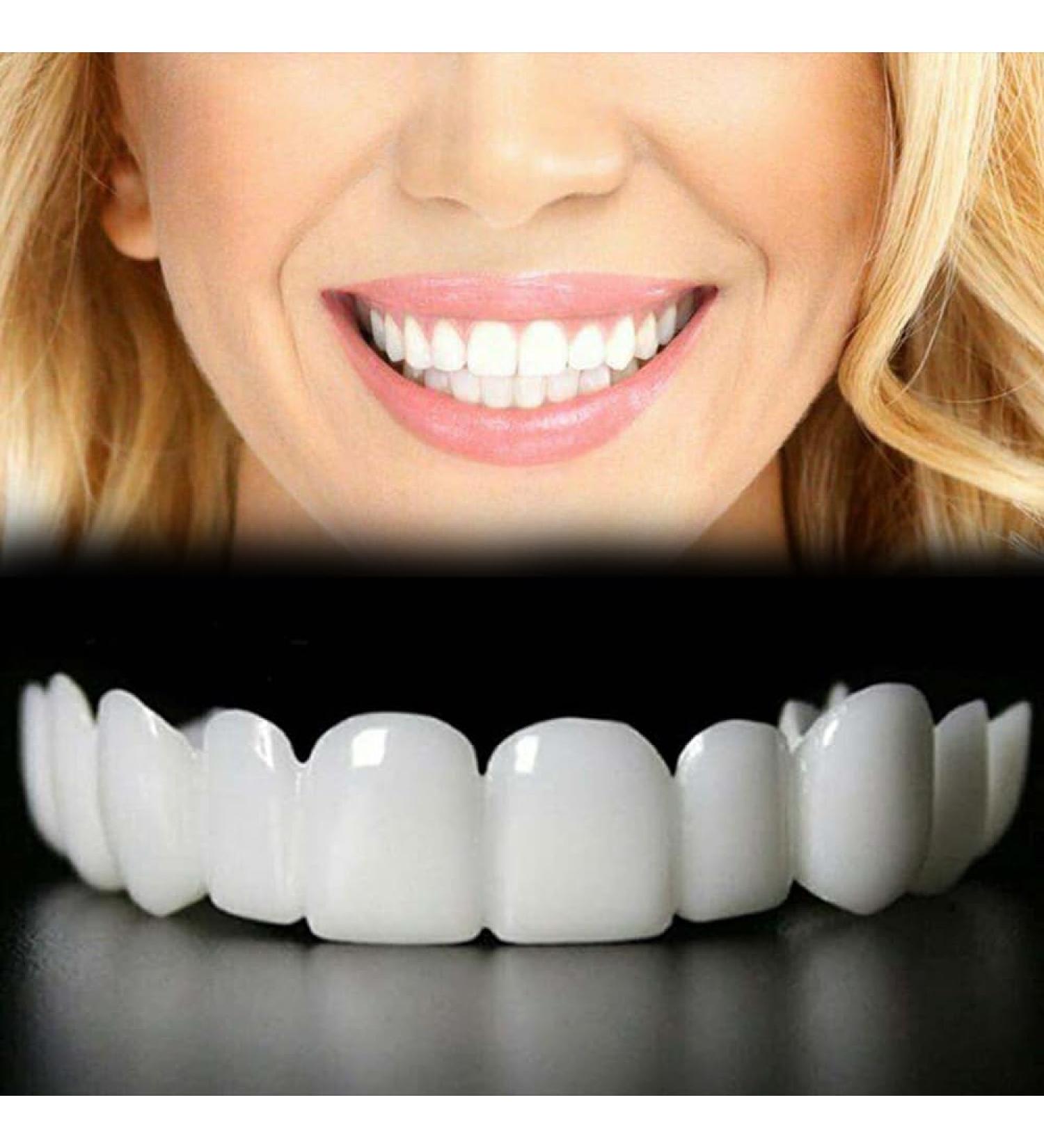 2 Pairs Adjustable for Men and Women Top and Bottom Regain Confident Smile - Buy Online on GoSupps.com