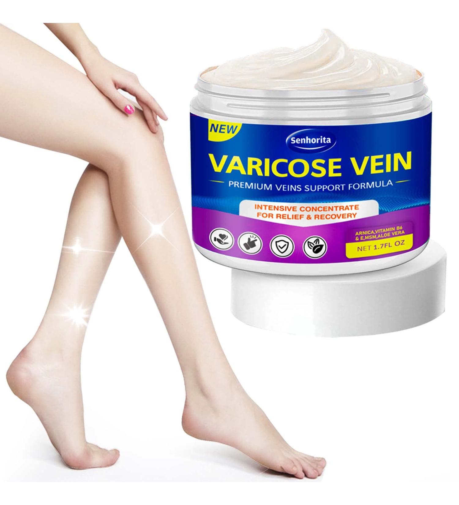 Varicose Veins Cream - Effective Treatment for Legs | Strengthen Capillaries, Improve Circulation | Relief Phlebitis Angiitis Inflammation | 1.7 Fl Oz - Buy Online on GoSupps.com