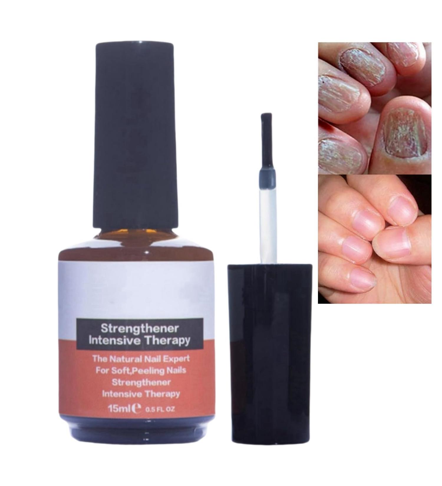 Nail Strengthening Treatment for Damaged Nails Nail Polish Strengthener Nail Hardner Oil Clear Nail Polish Strengthening Nail Growth and Strengthener Extreme Strength Nail Serum Nail Repair Serum - Buy Online on GoSupps.com