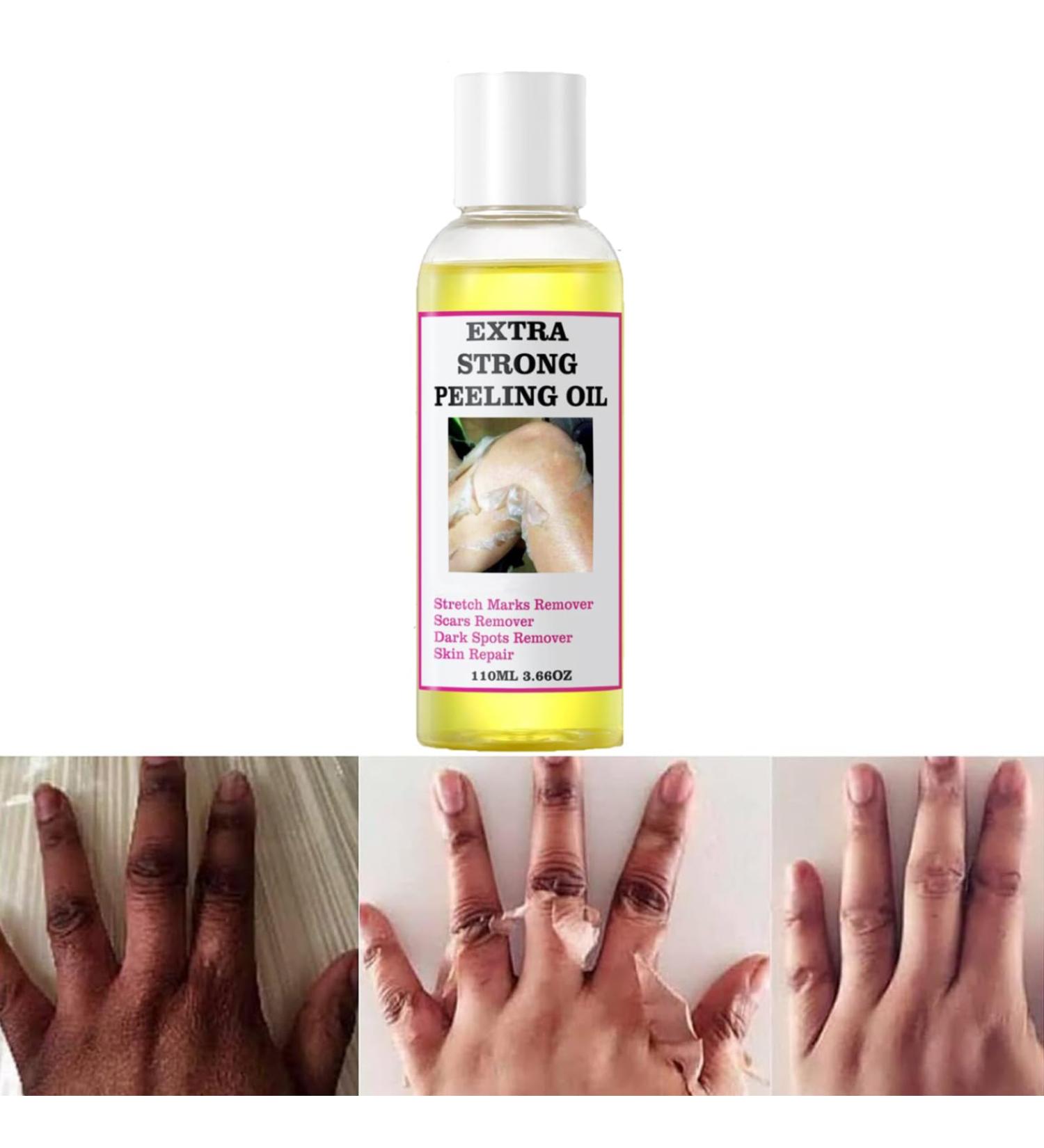Extra Strong Peeling Oil - Yellow Exfoliating Solution for Body Hands Feet & Face - All Skin Types (110ML - Buy Online on GoSupps.com