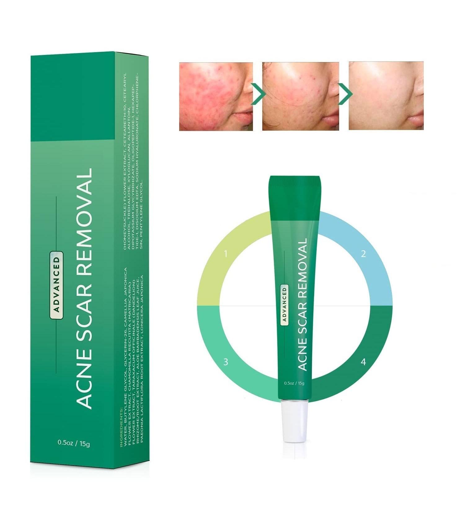 Hello Sunshine Advanced Gel Acne Scar Spot Treatment with Retinol, Allantoin, Vitamin E, Betaine - 0.5 OZ - Buy Online on GoSupps.com