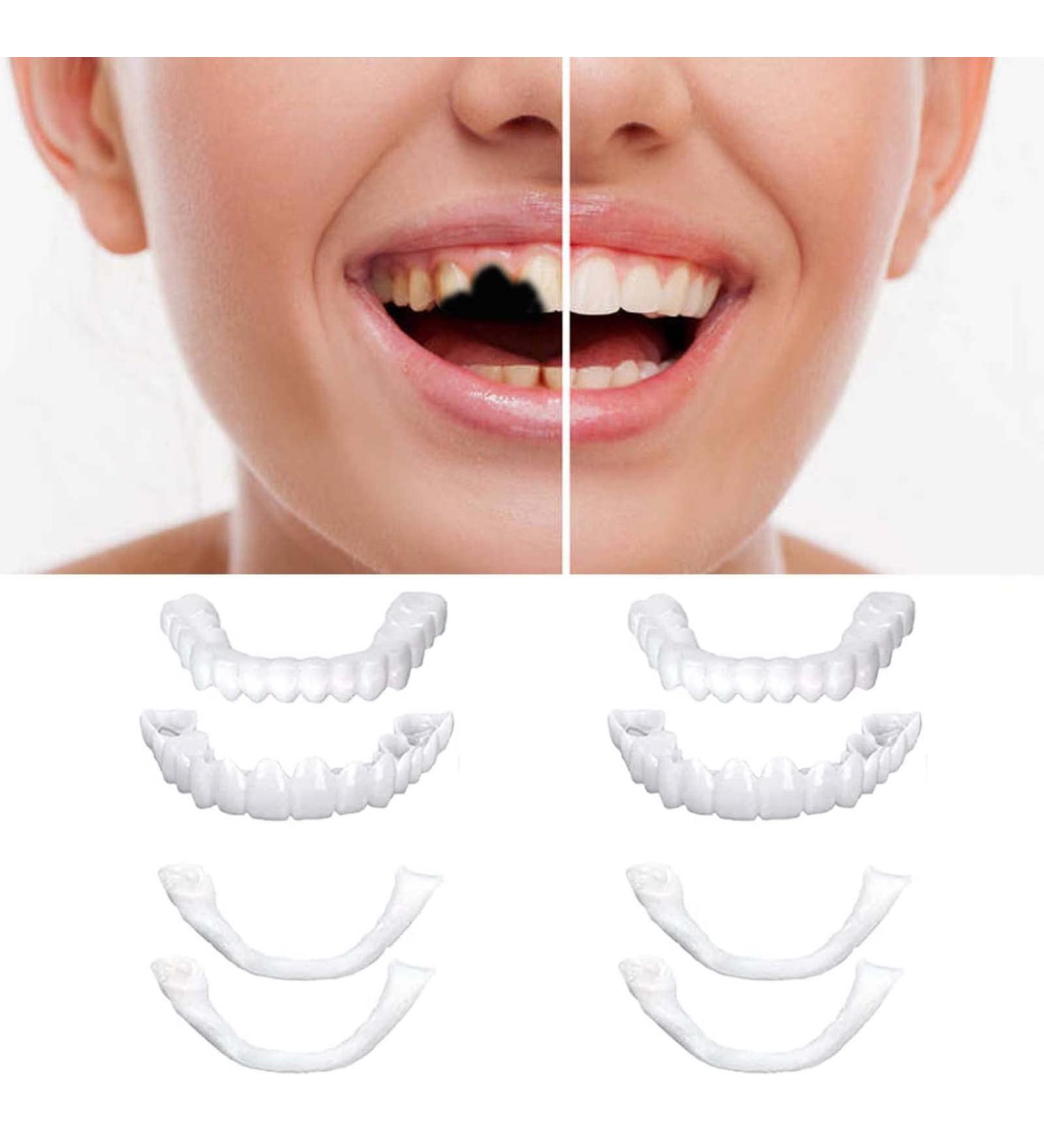 2 Pairs Veneers Dentures - Temporary Tooth Repair for Imperfect Teeth - Buy Online on GoSupps.com