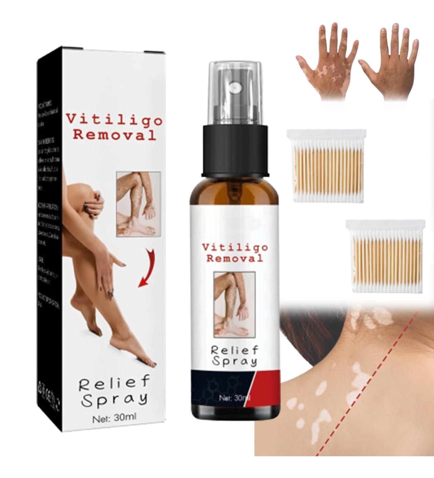 Alkyne Vitiligo Removal Relief Spray - Skin Repair & Treatment for Vitiligo Care (1pc) - Buy Online on GoSupps.com