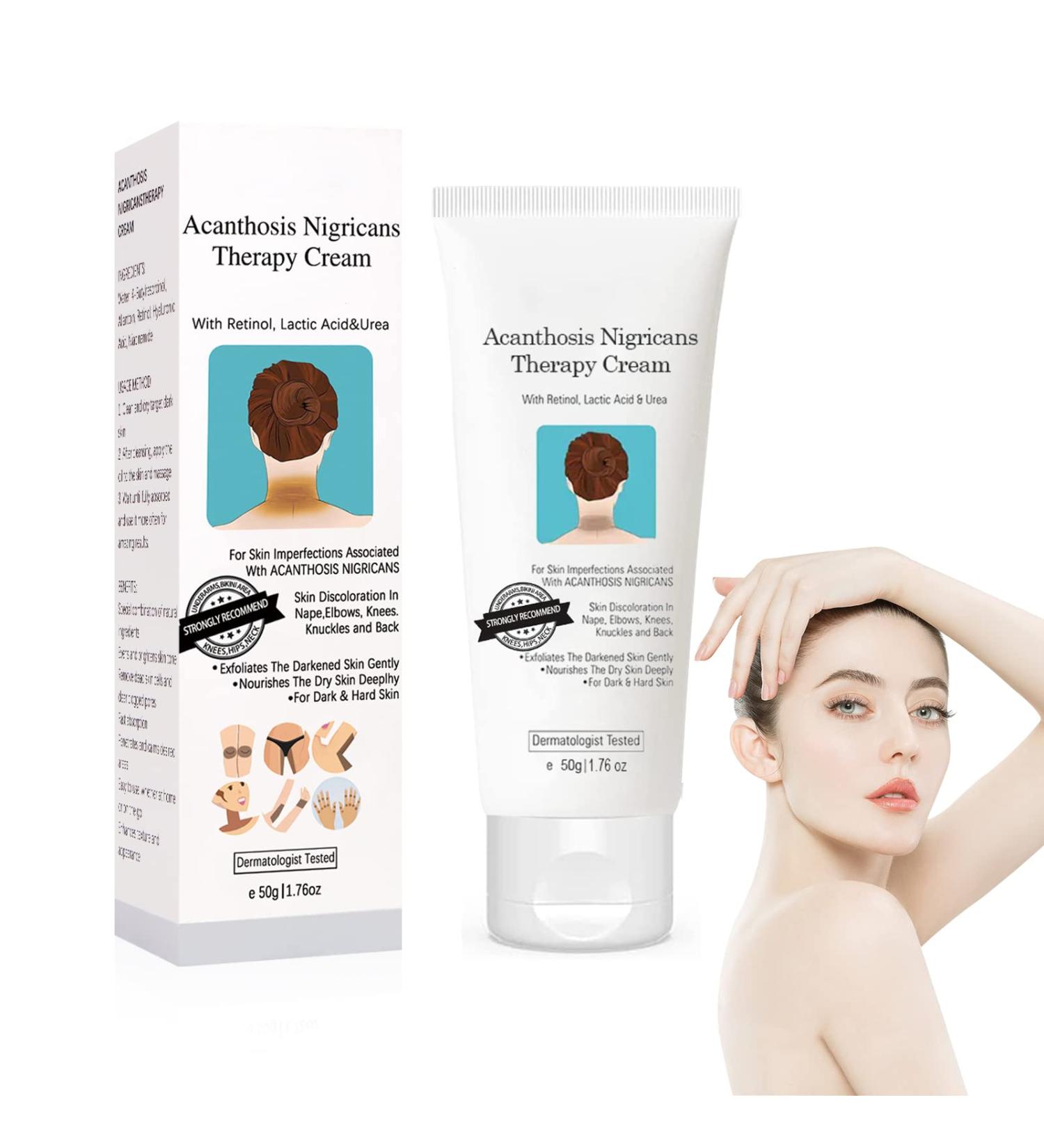 Acanthosis Nigricans Cream Whitening Cream Underarm Whitening Cream Brightening Cream Effectively Lightens Melanin Neck Ankle Knee - Buy Online on GoSupps.com