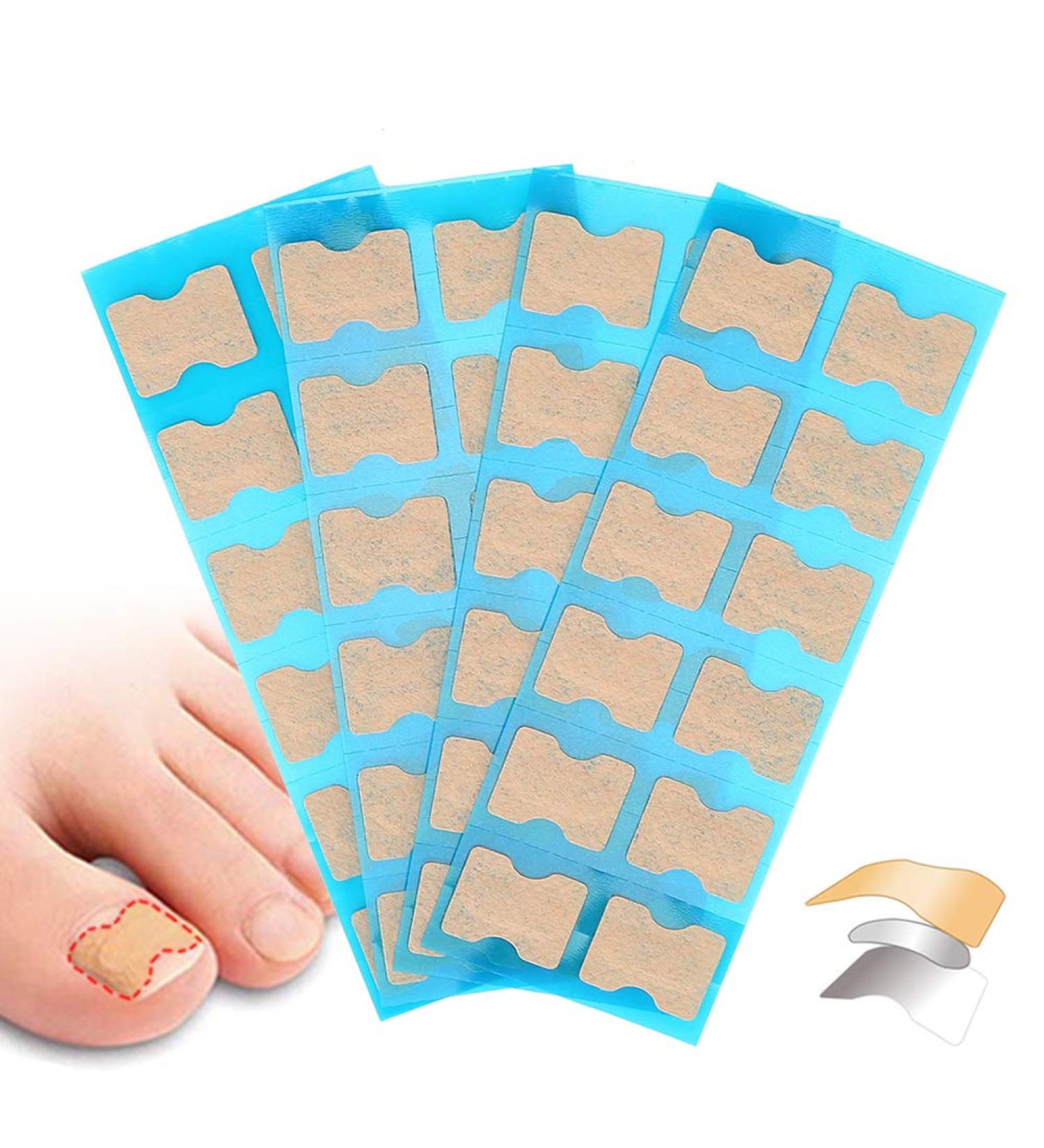 Ingrown Toenail Correction Patch - 4 Sizes, Glue-Free Toe Nail Corrector for Paronychia, Foot Care Treatment - Pedicure Tool - Buy Online on GoSupps.com