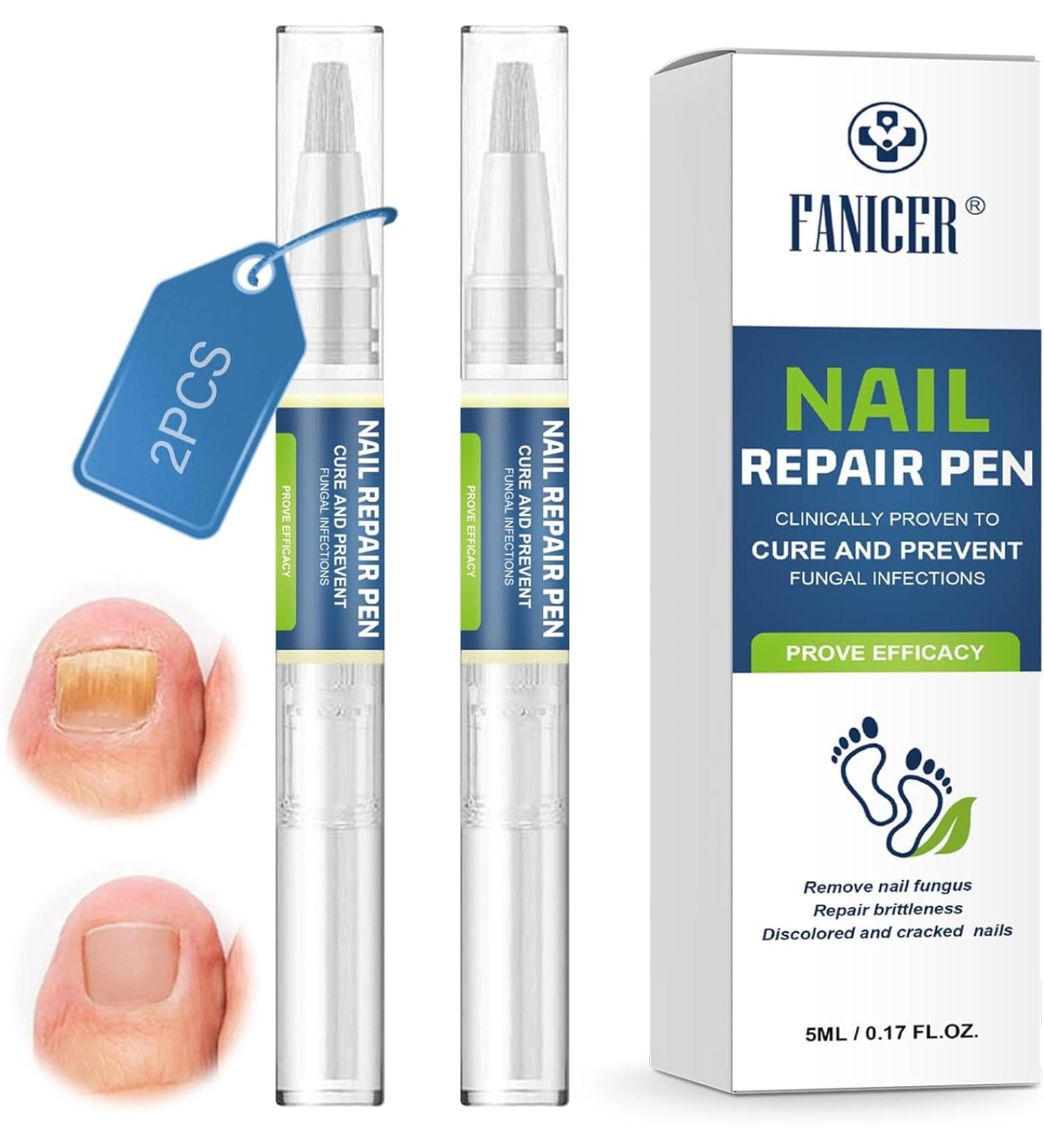 Lot de 2 stylos de r paration pour ongles - Pour ongles et orteils soign s - Protection et renforcement des ongles cassants - Am liore l'apparence des ongles endommag s par les ongles bleu 1 pi ce - Buy Online on GoSupps.com