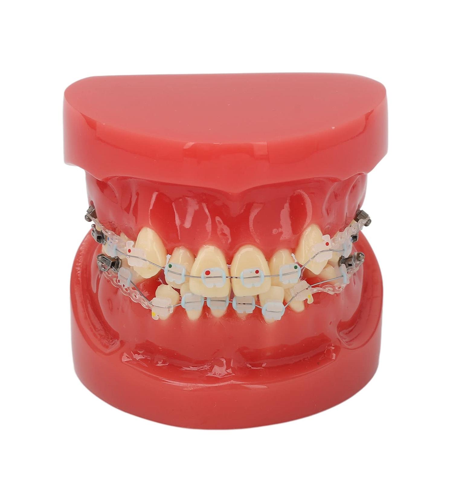 Orthodontic Ceramic Model - 24 Teeth Demonstration for Clear Orthodontic Process Representation - Buy Online on GoSupps.com