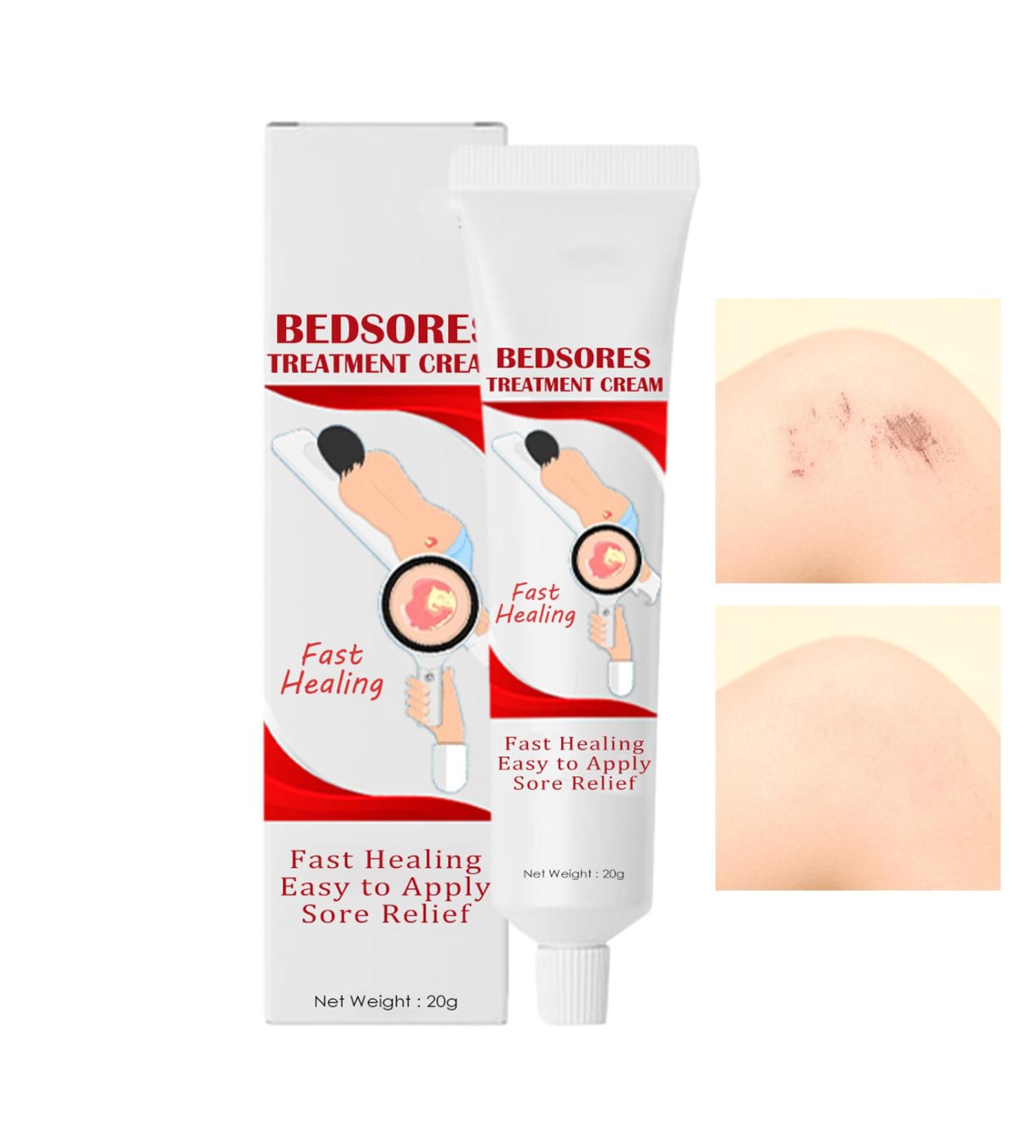  G n rique Bedsore Treatment Cream Fast-Acting Bedsor Cream 20g Soothing Relief for Bedsores Fast Healing Improves Elasticity and Repairs Damaged Skin - Buy Online on GoSupps.com