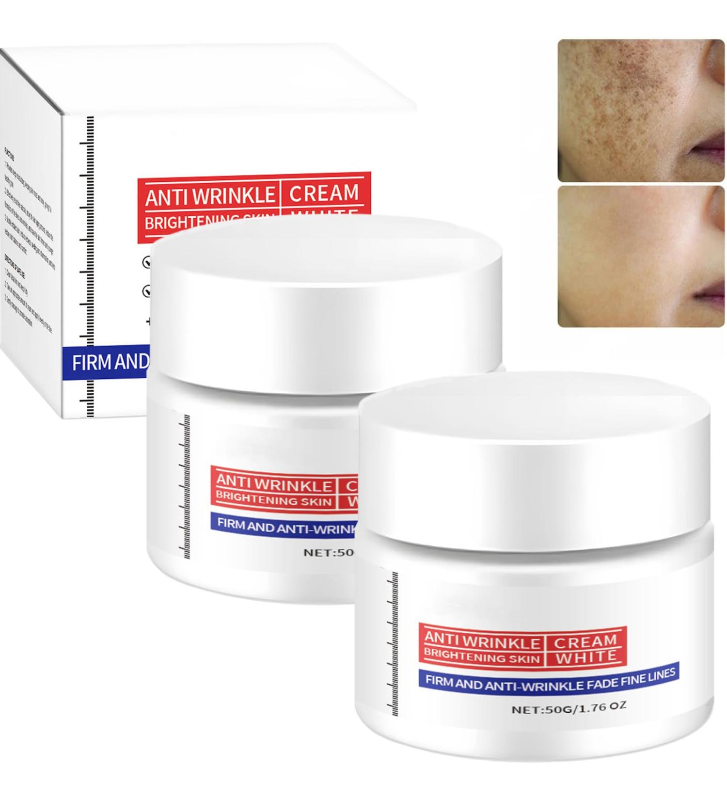 Aobenz Spot Remover for Face Sun Spot Sun Spot Dark Spot Remover Dark Spot Corrector Serum 50g (1pc) - Buy Online on GoSupps.com