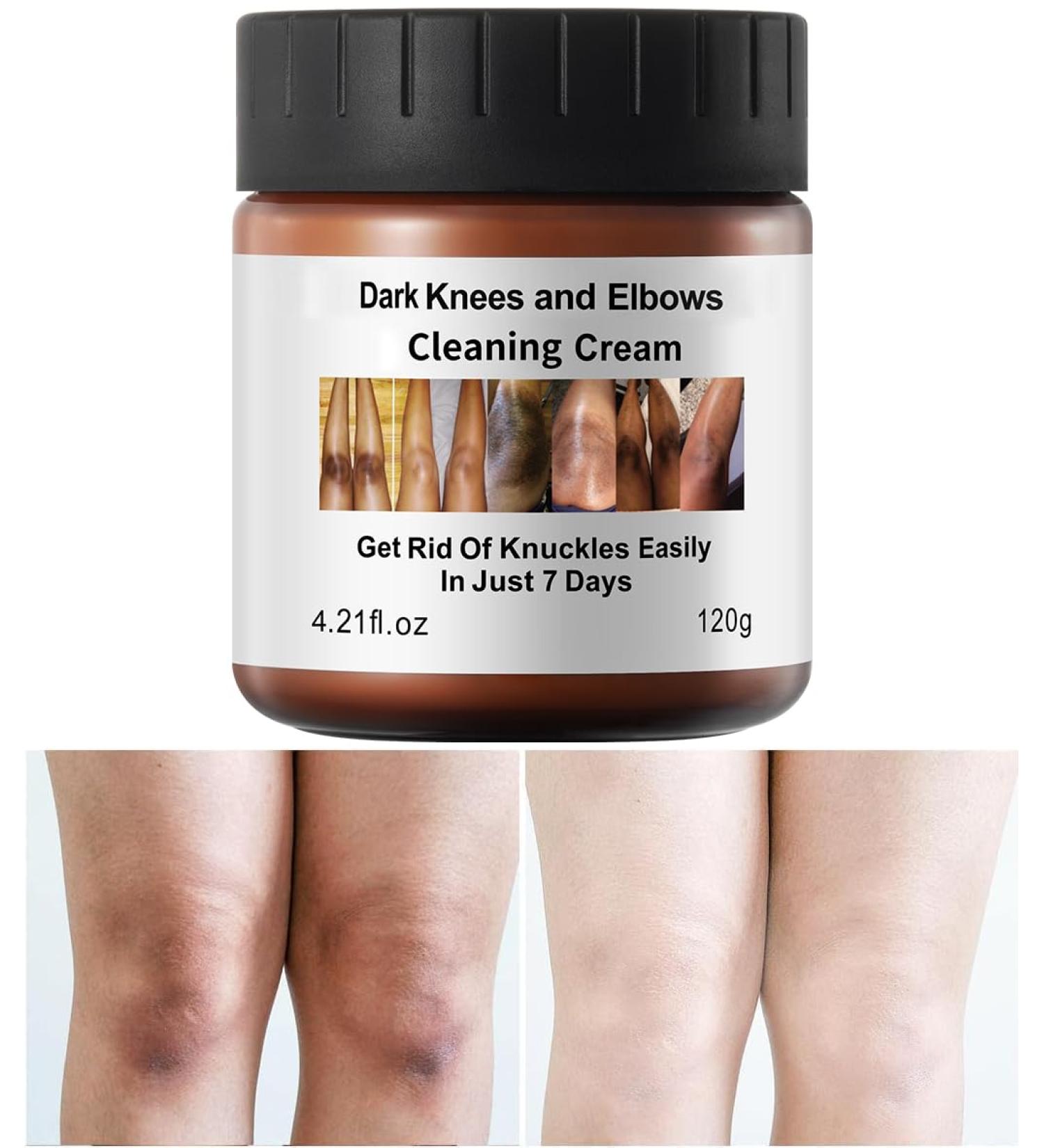 Dark Knees Elbows Knuckles Corrector Cream Skin Cleaning Bleaching Cream for Elbows Knees Armpit Underarm Inner thighs Intimate Areas Dark Spot (120g/4.2oz) - Buy Online on GoSupps.com